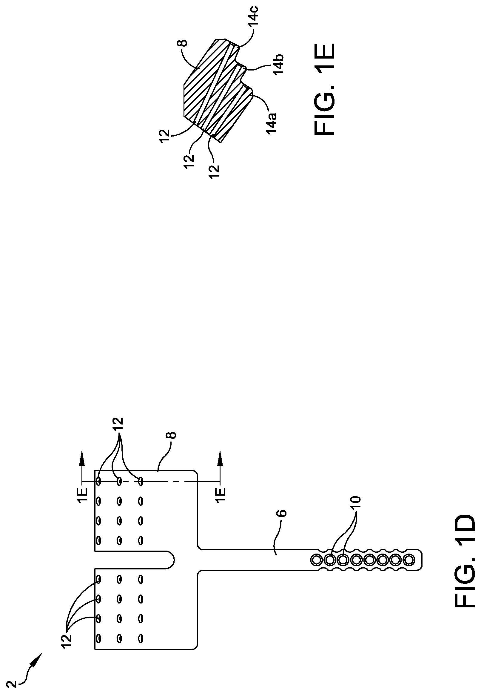 Patent US11779360 Figure 3 – Chevron osteotomy tools and methods