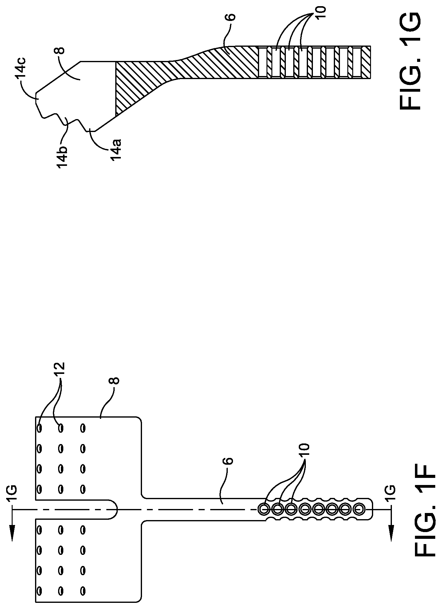 Patent US11779360 Figure 4 – Chevron osteotomy tools and methods
