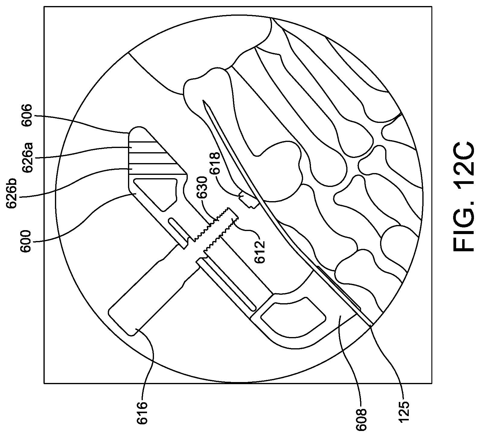 Patent US11779360 Figure 17 – Chevron osteotomy tools and methods