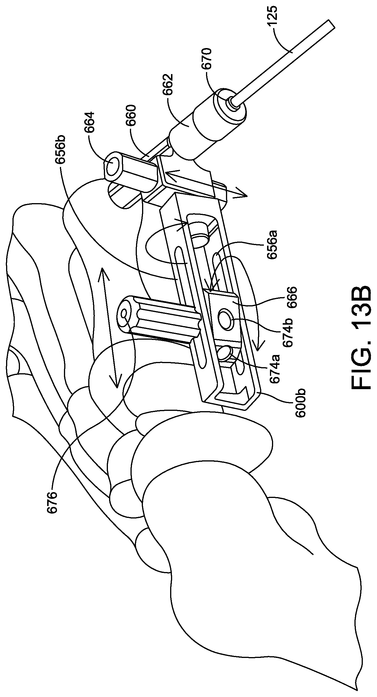 Patent US11779360 Figure 19 – Chevron osteotomy tools and methods