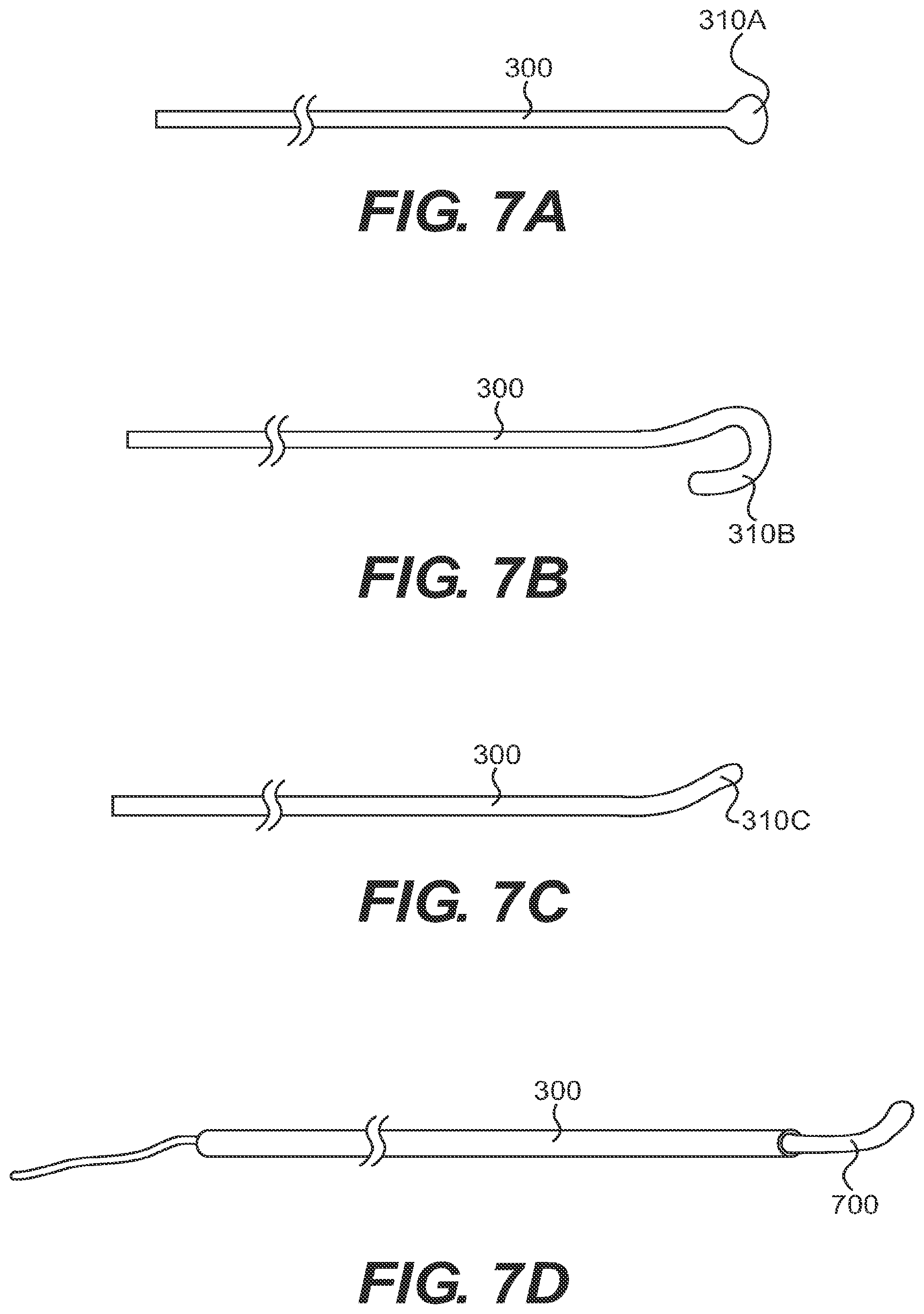 Patent US11779361 Figure 7 – Endovascular devices and methods for exploiting intramural space
