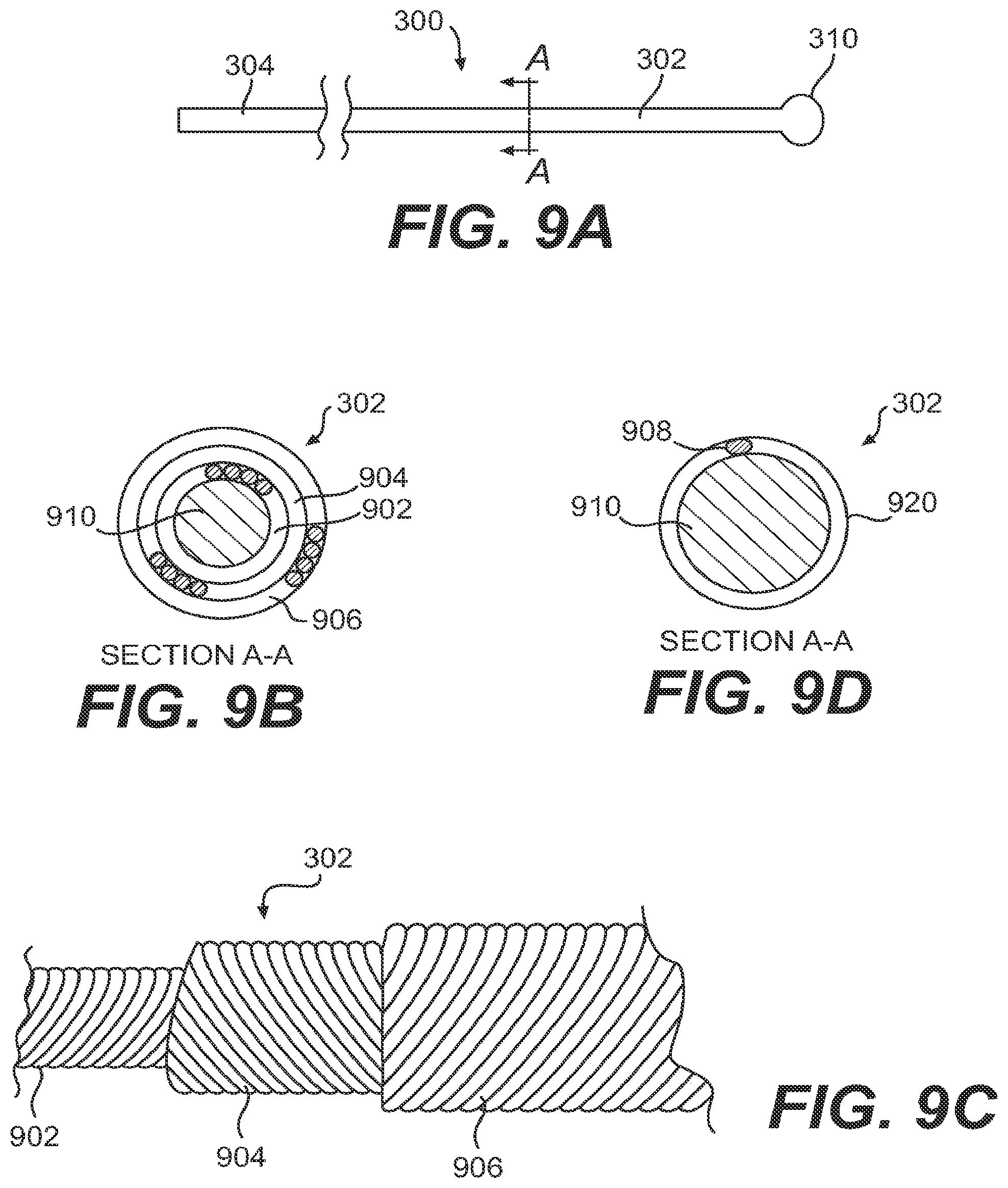 Patent US11779361 Figure 9 – Endovascular devices and methods for exploiting intramural space