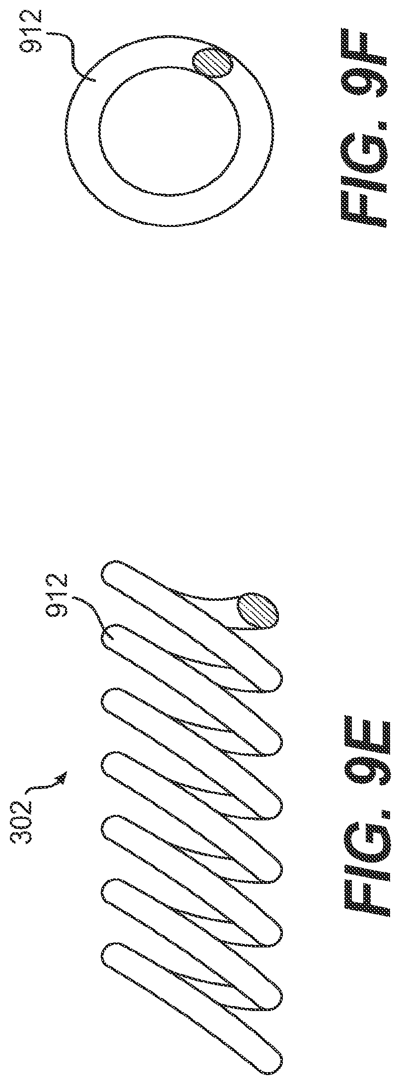 Patent US11779361 Figure 10 – Endovascular devices and methods for exploiting intramural space
