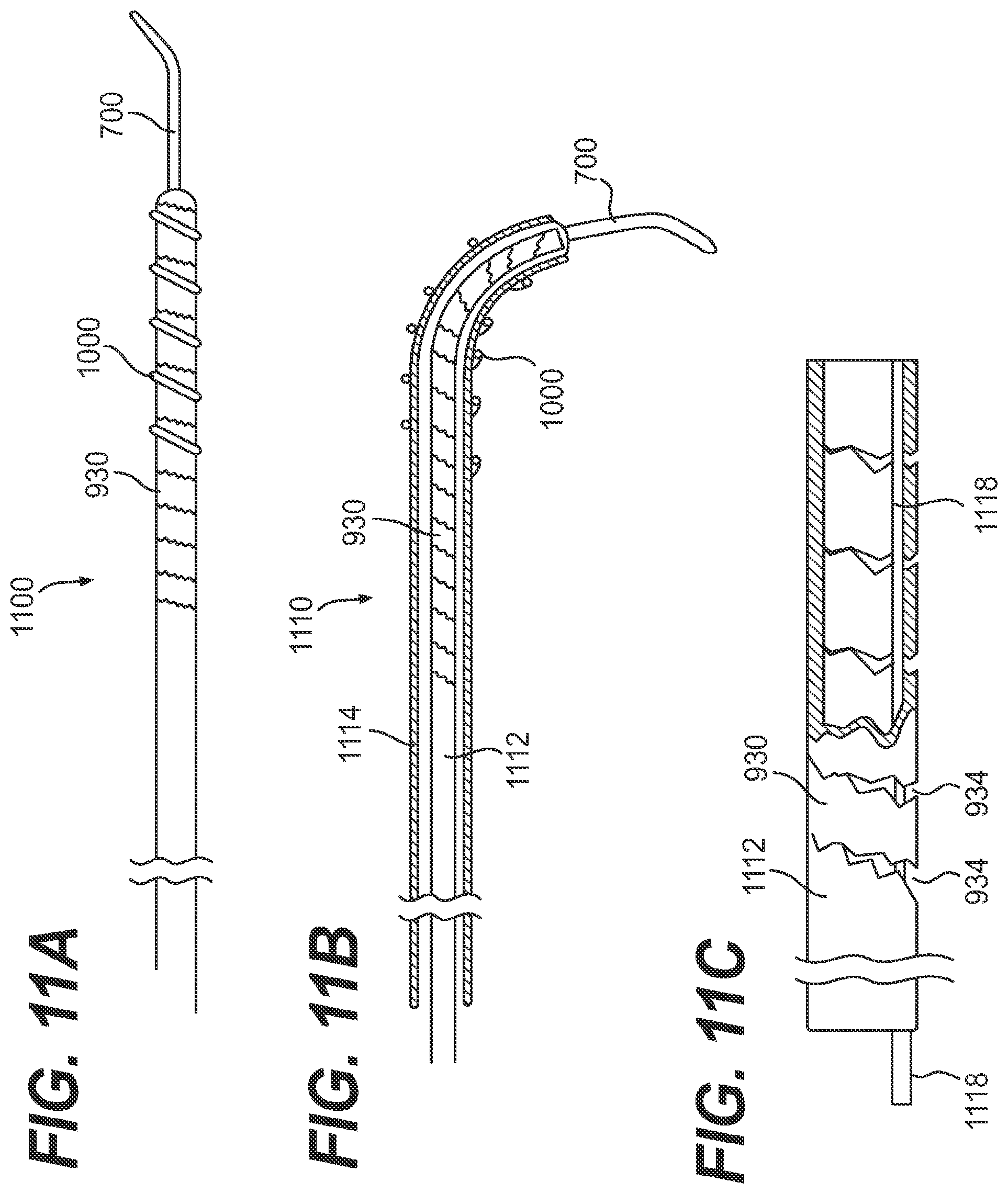 Patent US11779361 Figure 14 – Endovascular devices and methods for exploiting intramural space