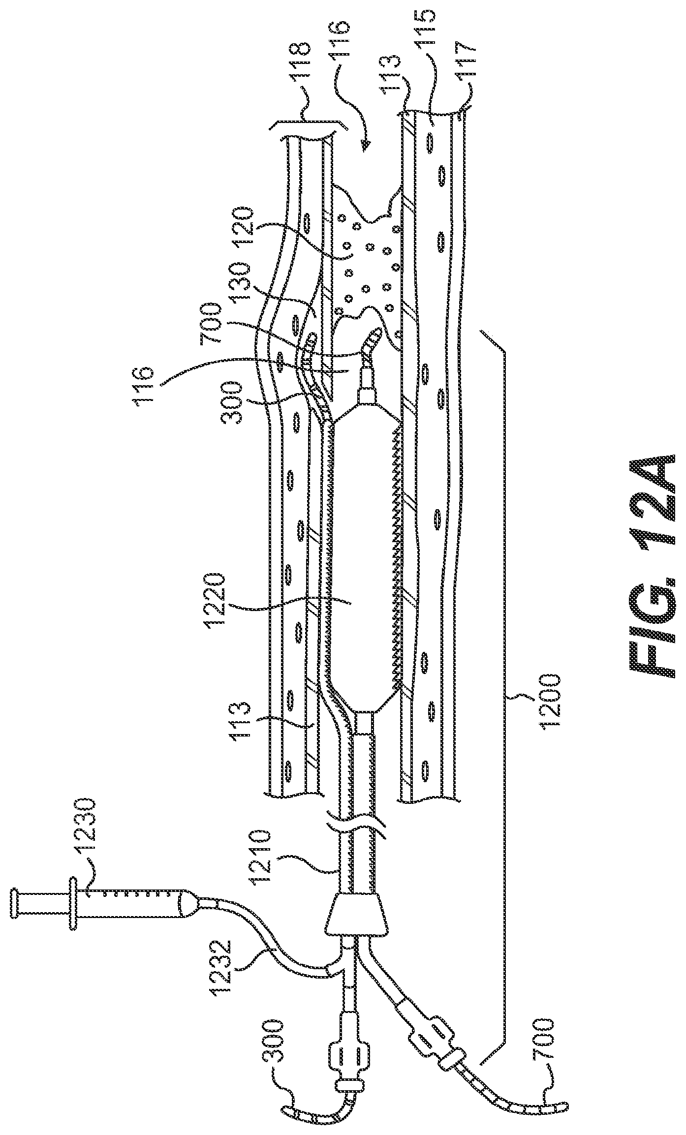 Patent US11779361 Figure 15 – Endovascular devices and methods for exploiting intramural space