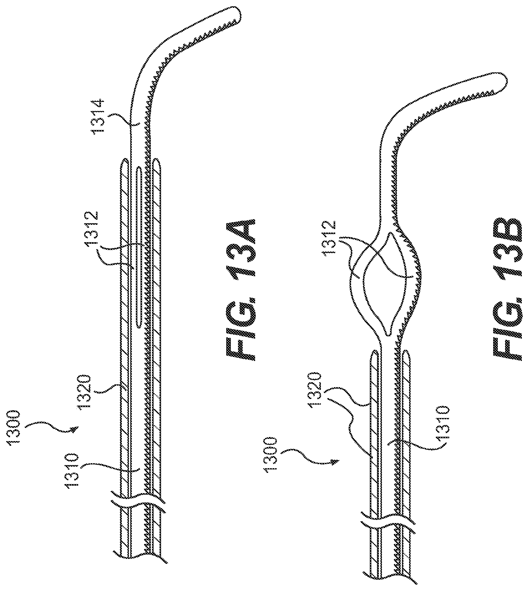 Patent US11779361 Figure 18 – Endovascular devices and methods for exploiting intramural space