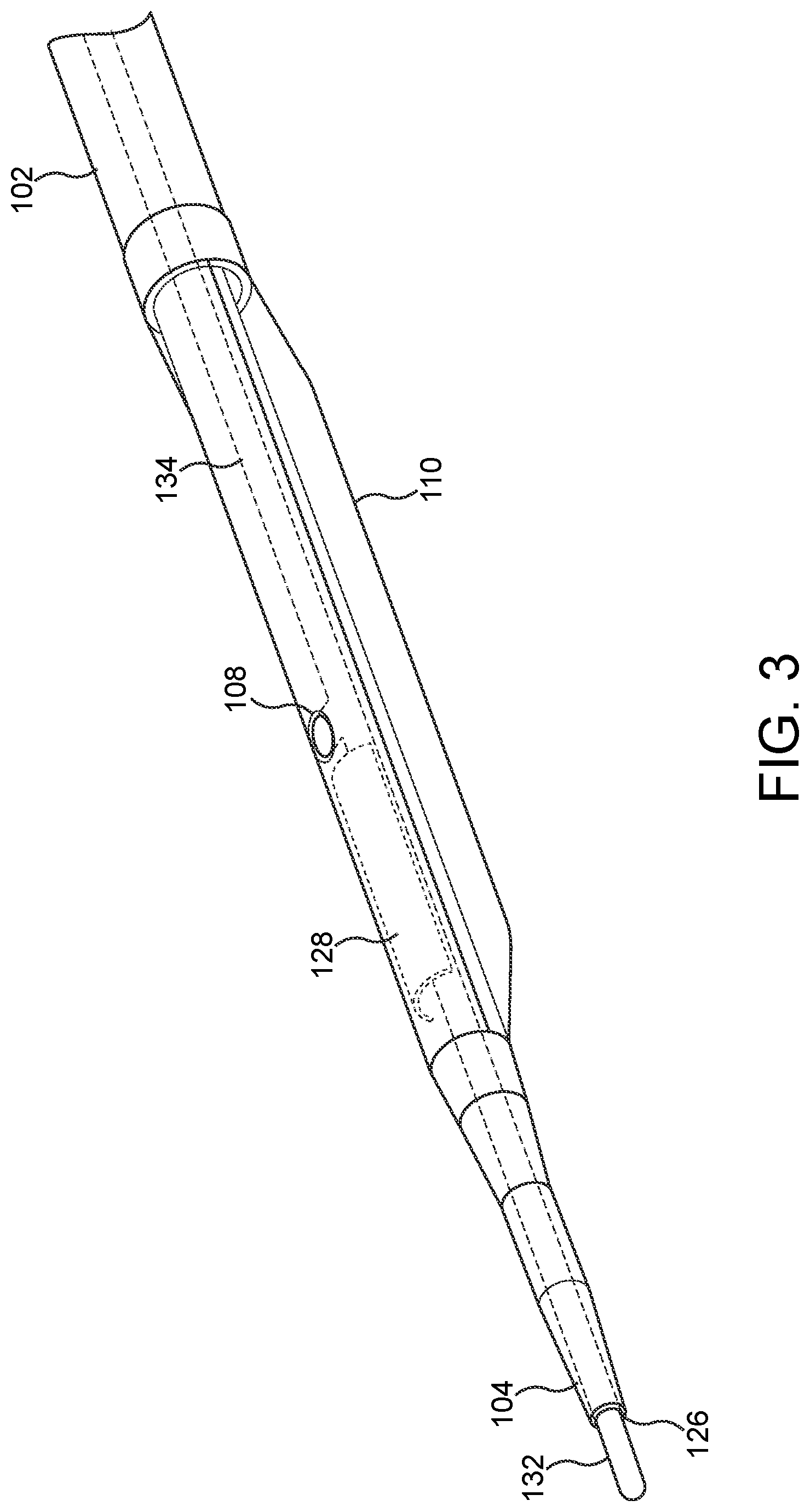 Patent US11779362 Figure 3 – Methods and apparatus for true lumen re-entry