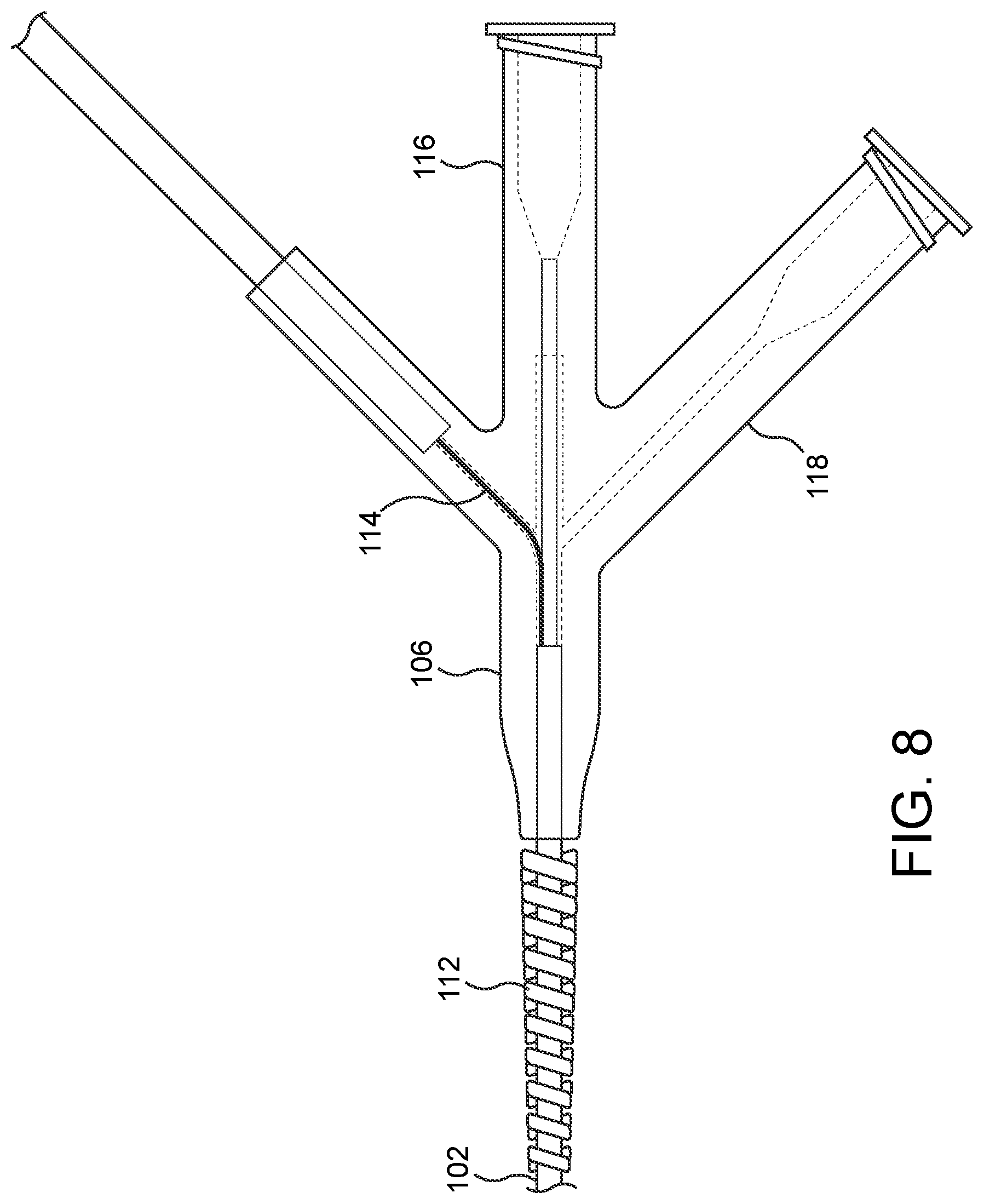 Patent US11779362 Figure 8 – Methods and apparatus for true lumen re-entry