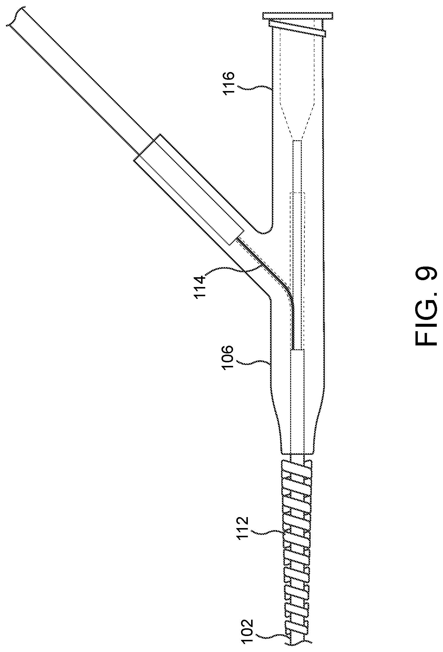 Patent US11779362 Figure 9 – Methods and apparatus for true lumen re-entry