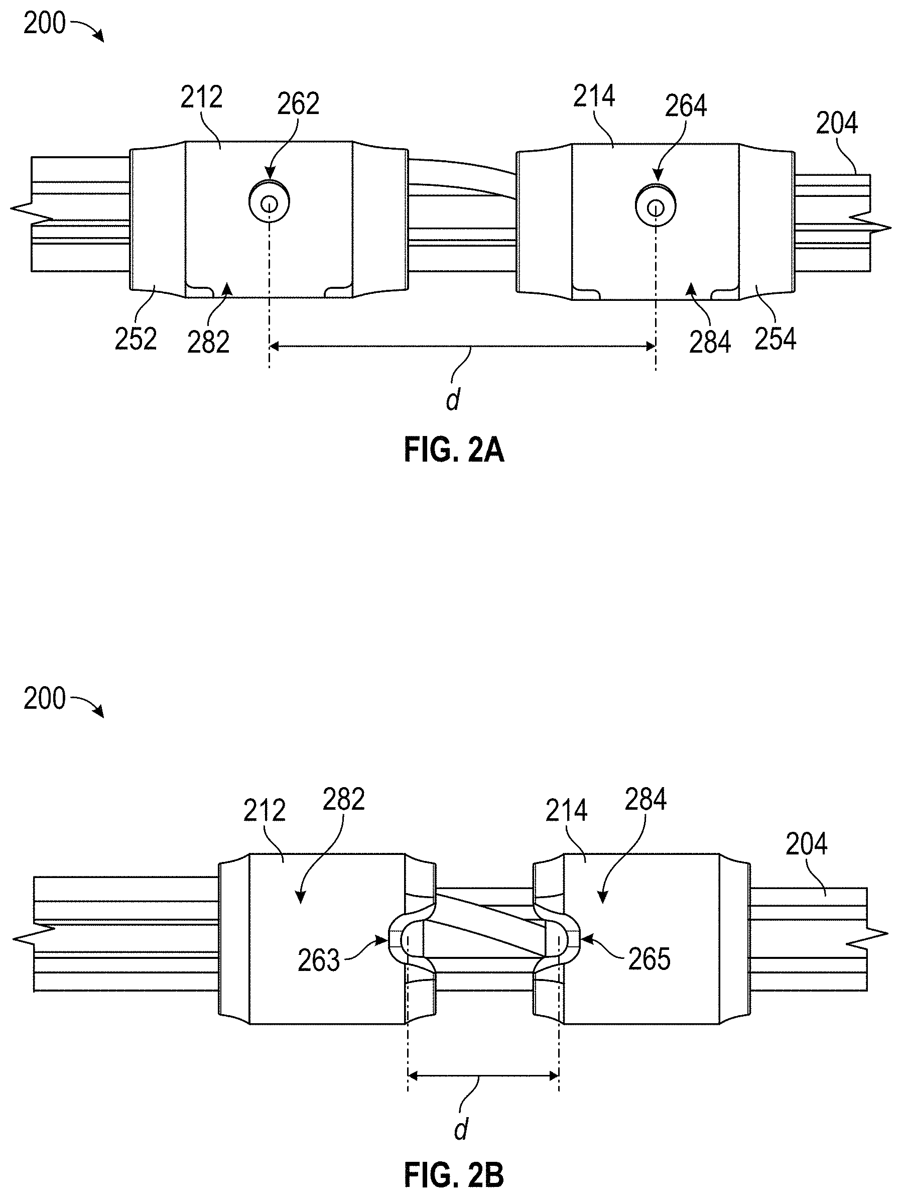 Patent US11779363 Figure 2 – Intravascular lithotripsy catheter with interfering shock waves