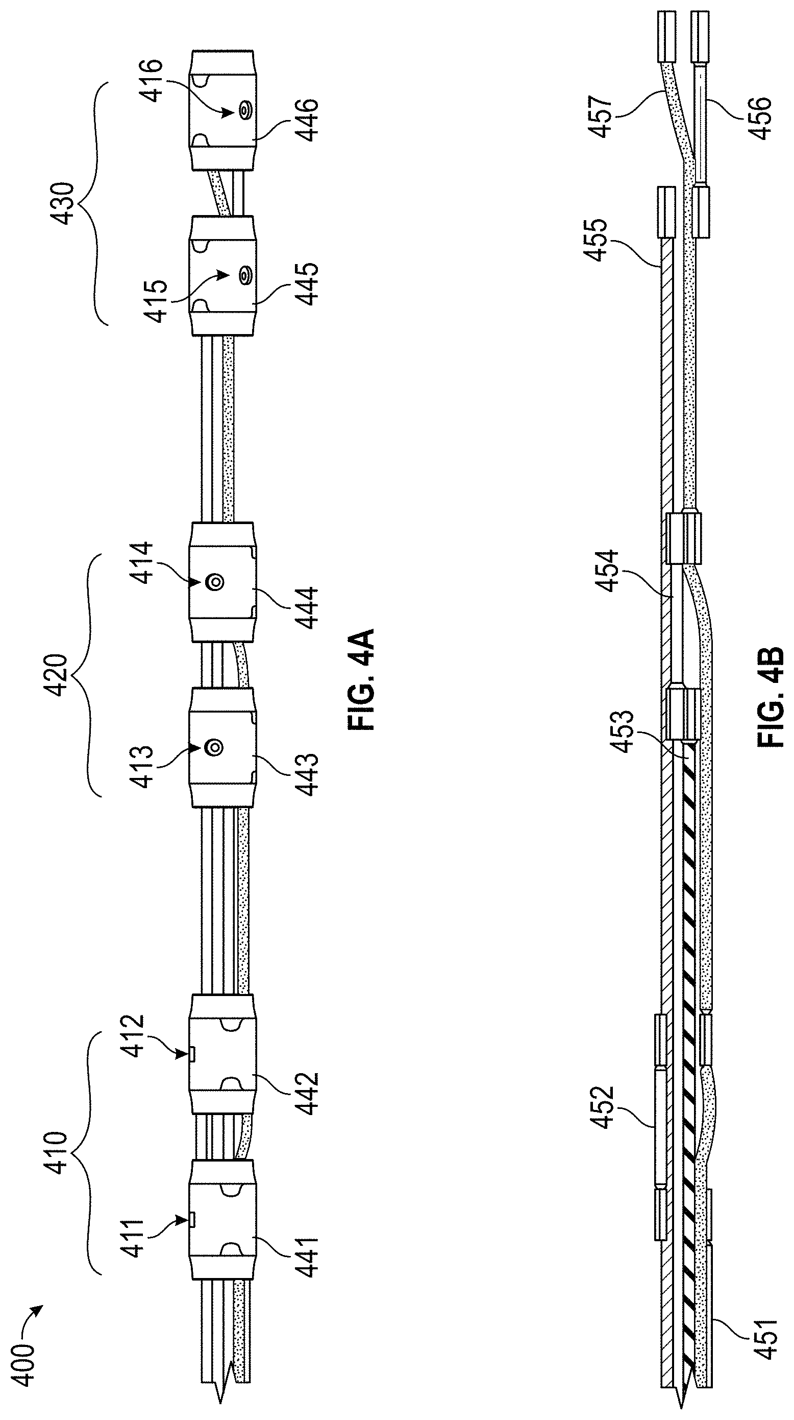 Patent US11779363 Figure 5 – Intravascular lithotripsy catheter with interfering shock waves