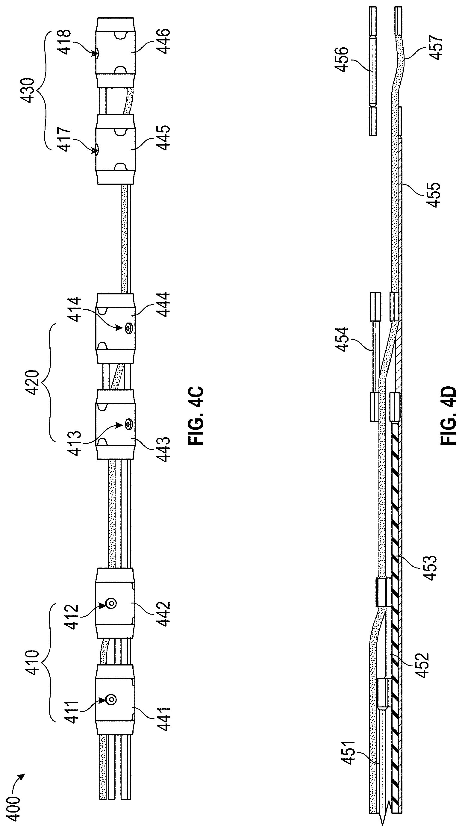 Patent US11779363 Figure 6 – Intravascular lithotripsy catheter with interfering shock waves