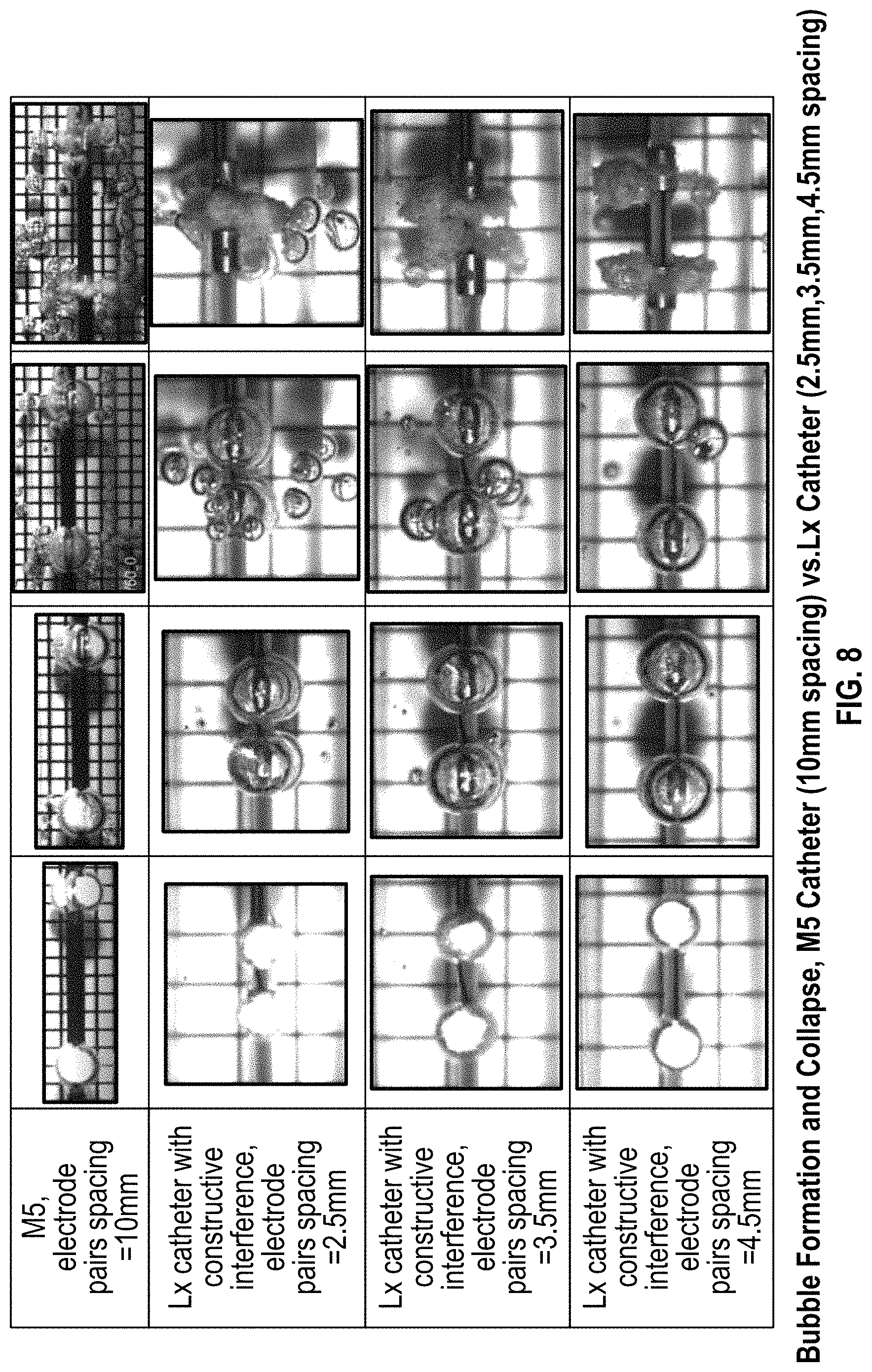 Patent US11779363 Figure 10 – Intravascular lithotripsy catheter with interfering shock waves