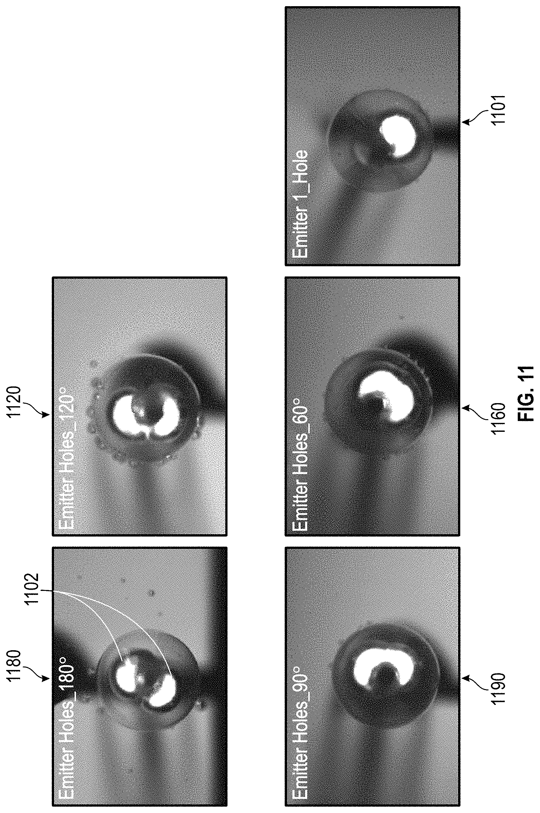 Patent US11779363 Figure 12 – Intravascular lithotripsy catheter with interfering shock waves