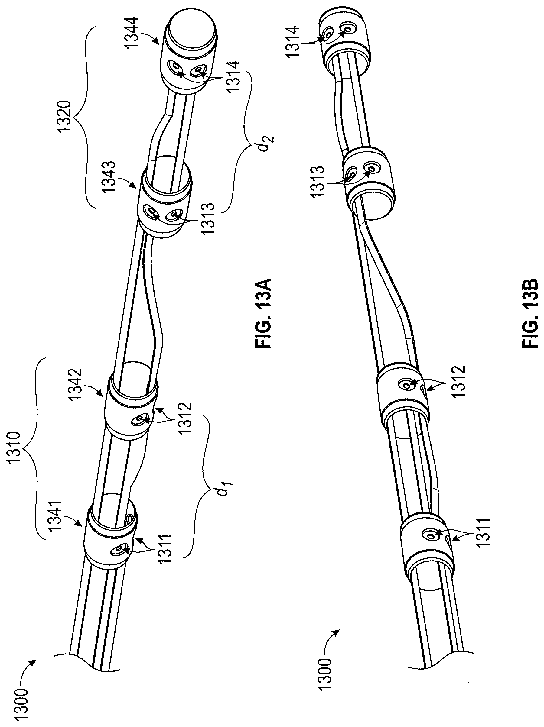 Patent US11779363 Figure 14 – Intravascular lithotripsy catheter with interfering shock waves
