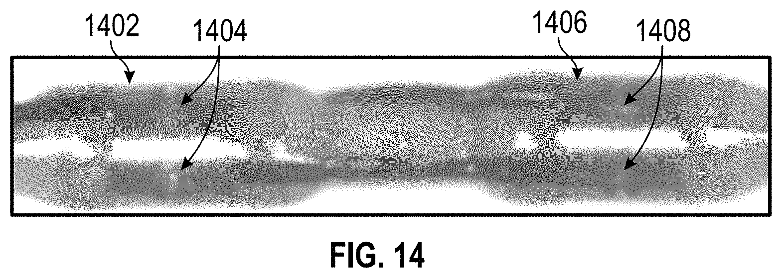 Patent US11779363 Figure 15 – Intravascular lithotripsy catheter with interfering shock waves
