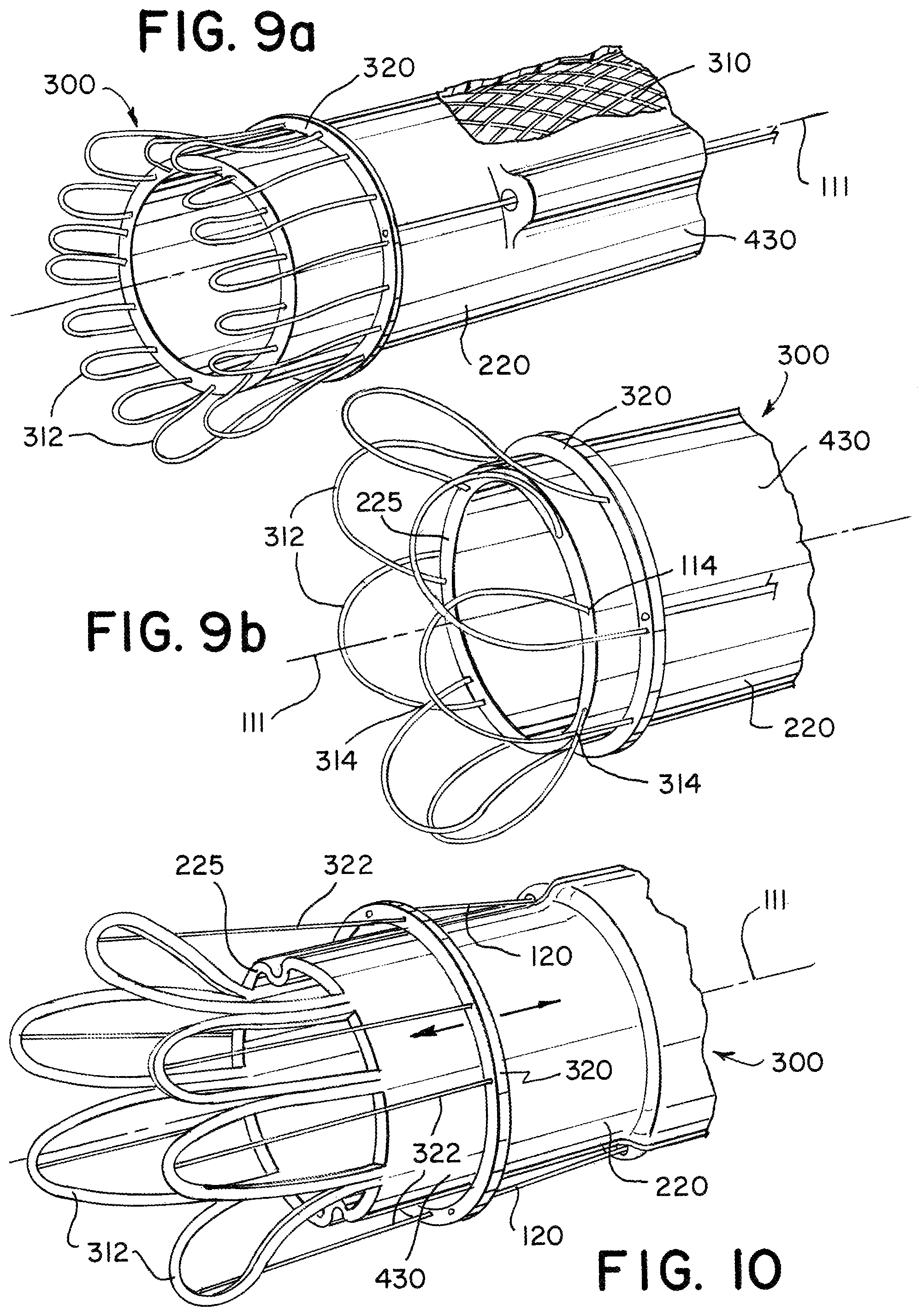 Patent US11779364 Figure 4 – Actuated expandable mouth thrombectomy catheter