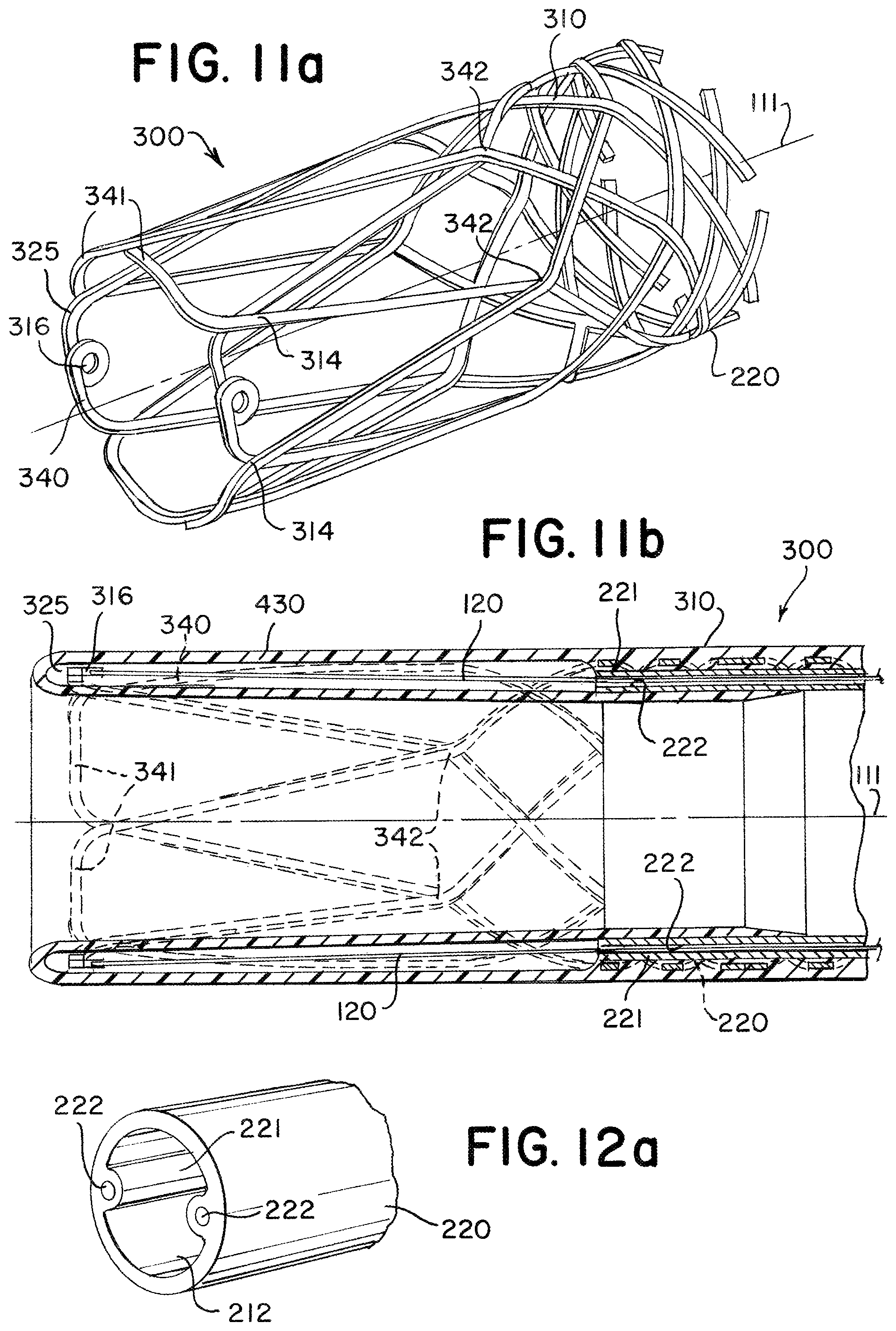 Patent US11779364 Figure 5 – Actuated expandable mouth thrombectomy catheter