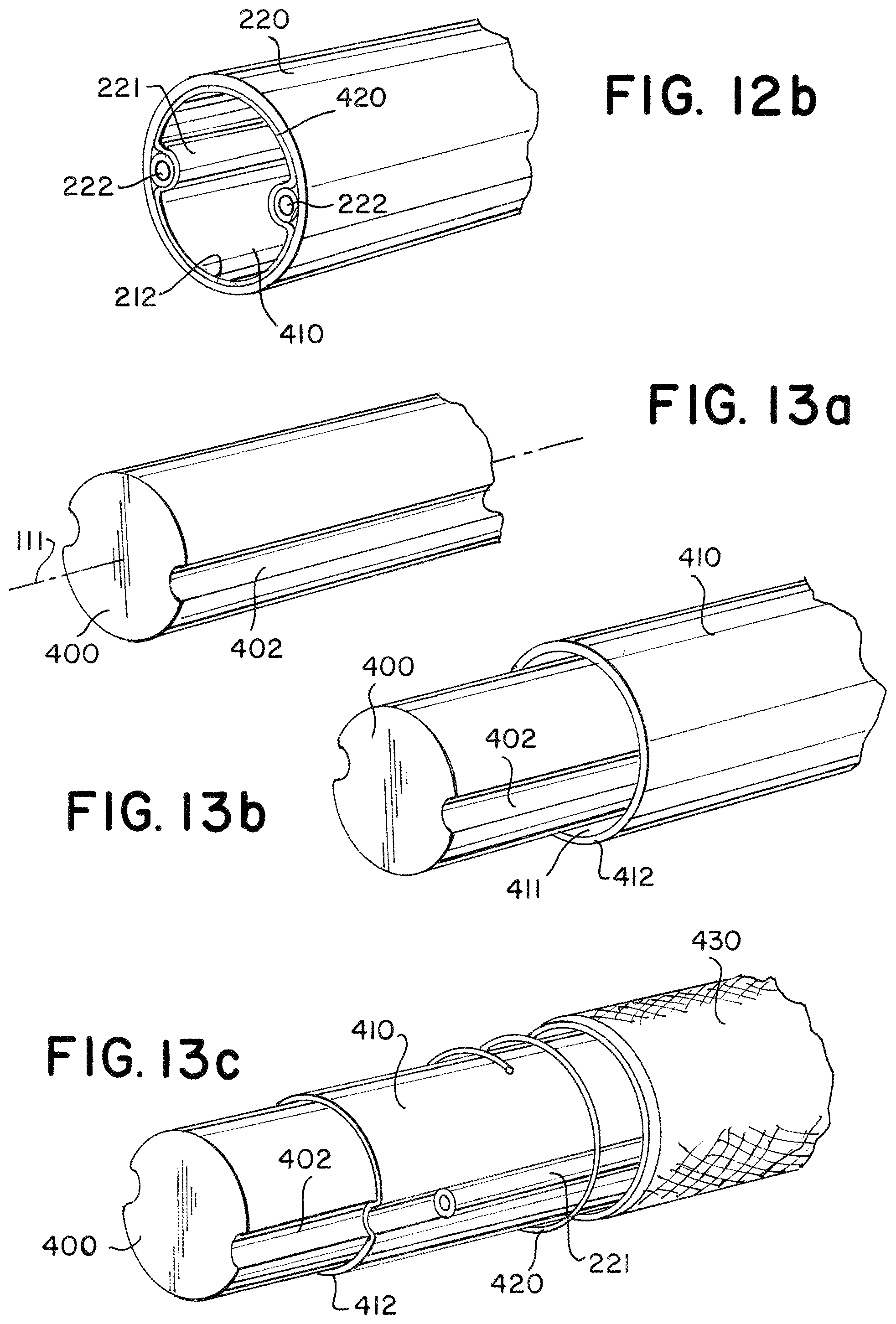 Patent US11779364 Figure 6 – Actuated expandable mouth thrombectomy catheter