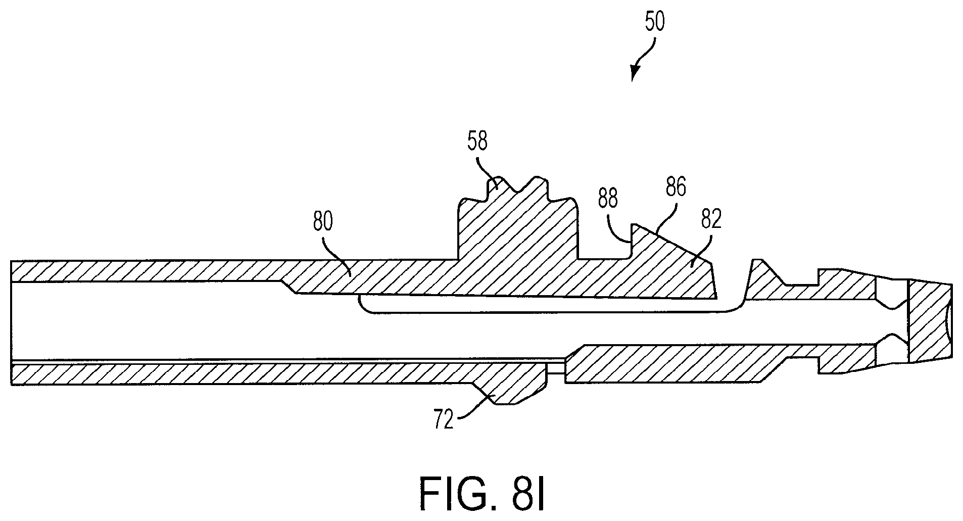 Patent US11779368 Figure 12 – Surgical knife safety handle having user operable lock