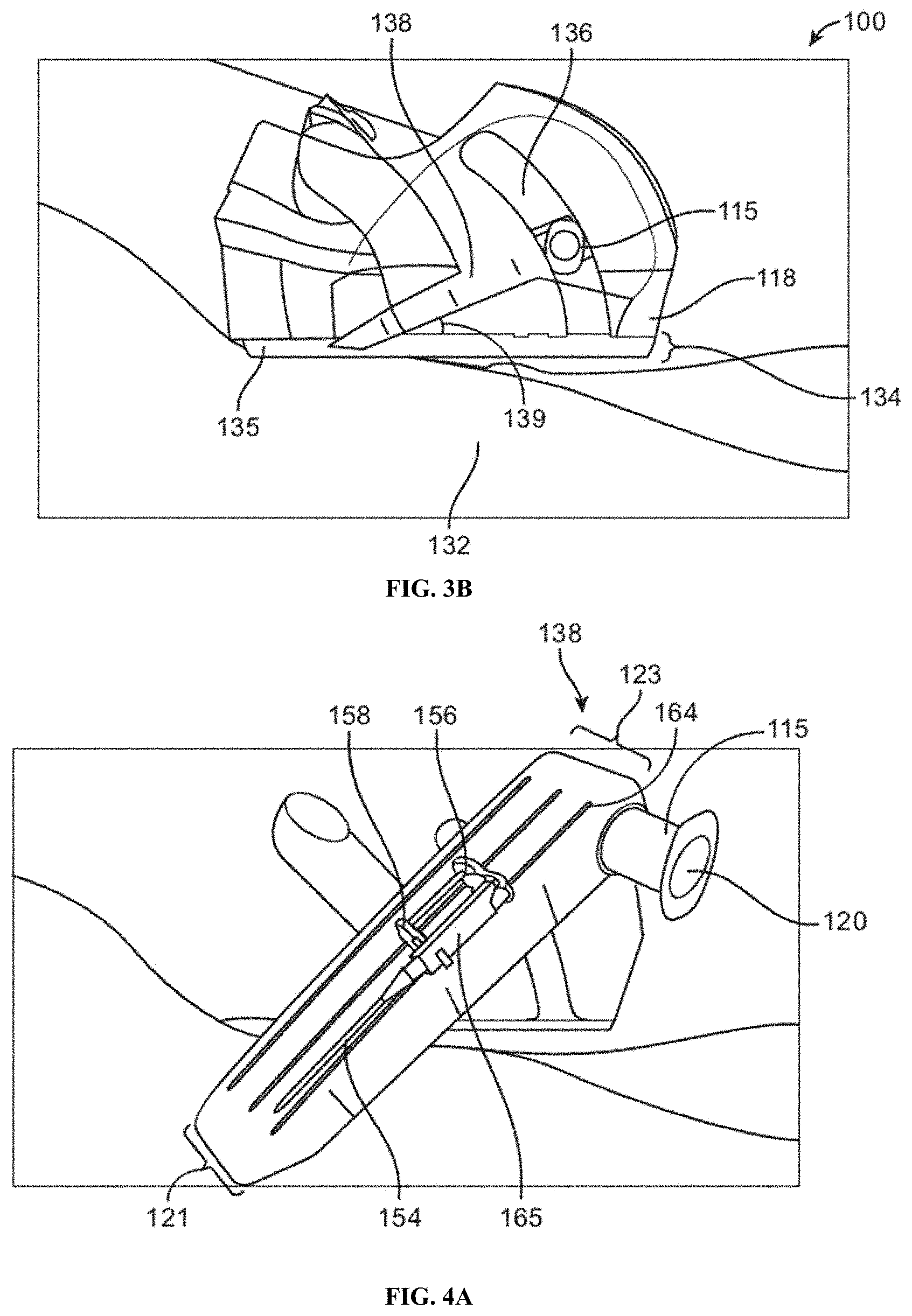 Patent US11779369 Figure 4 – Vacuum-assisted insertion device
