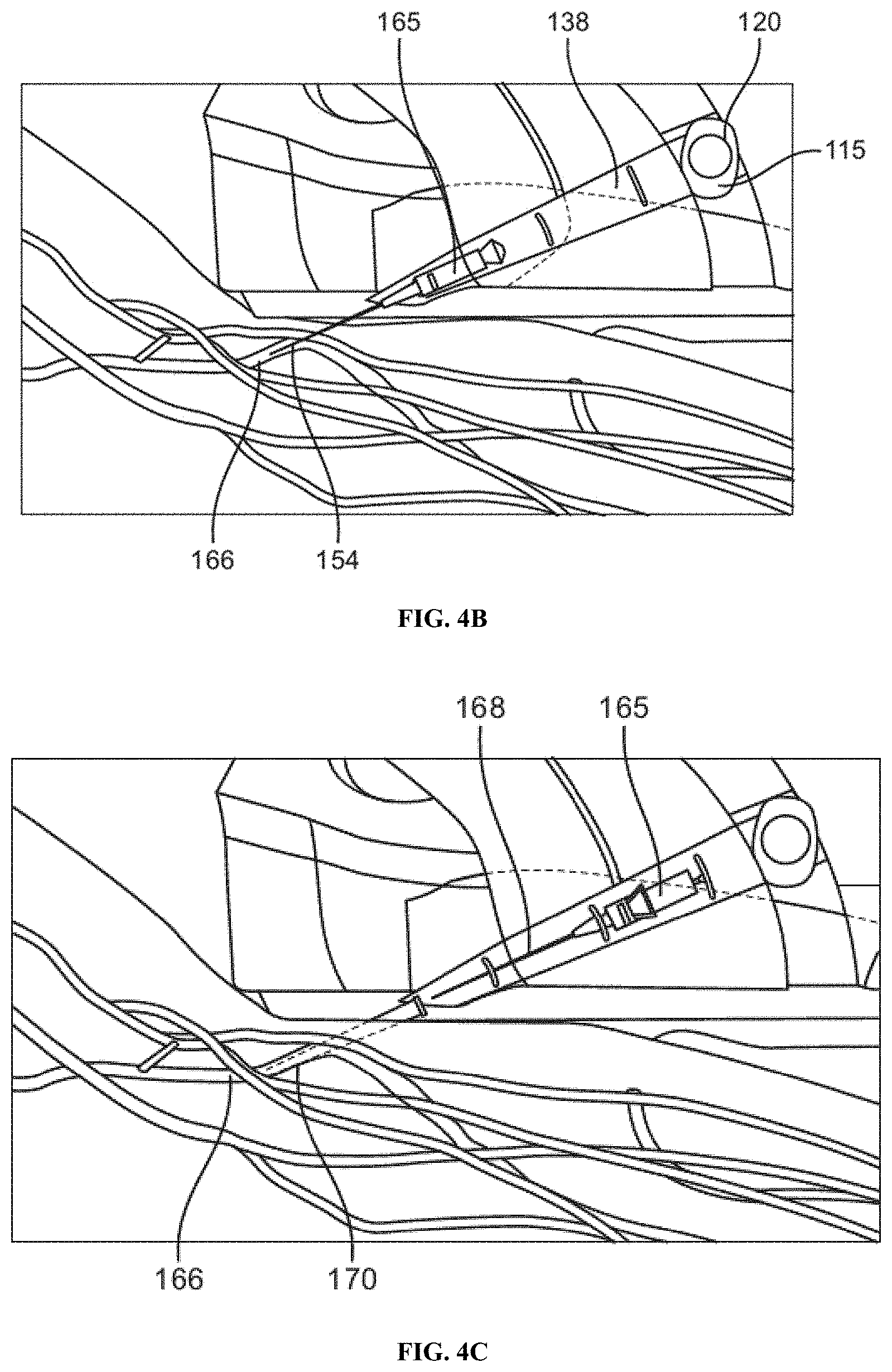 Patent US11779369 Figure 5 – Vacuum-assisted insertion device