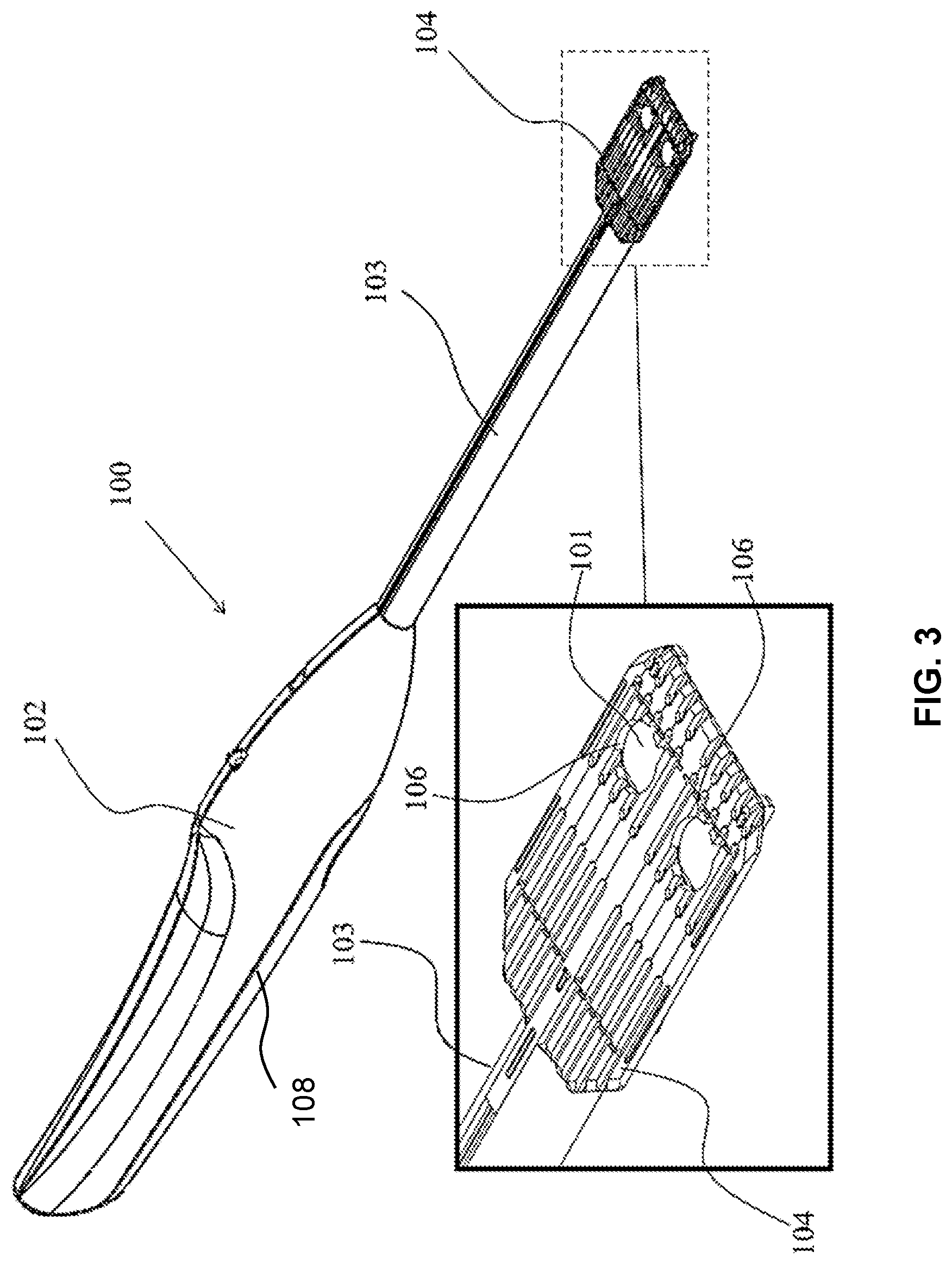 Patent US11779371 Figure 3 – Implant delivery device