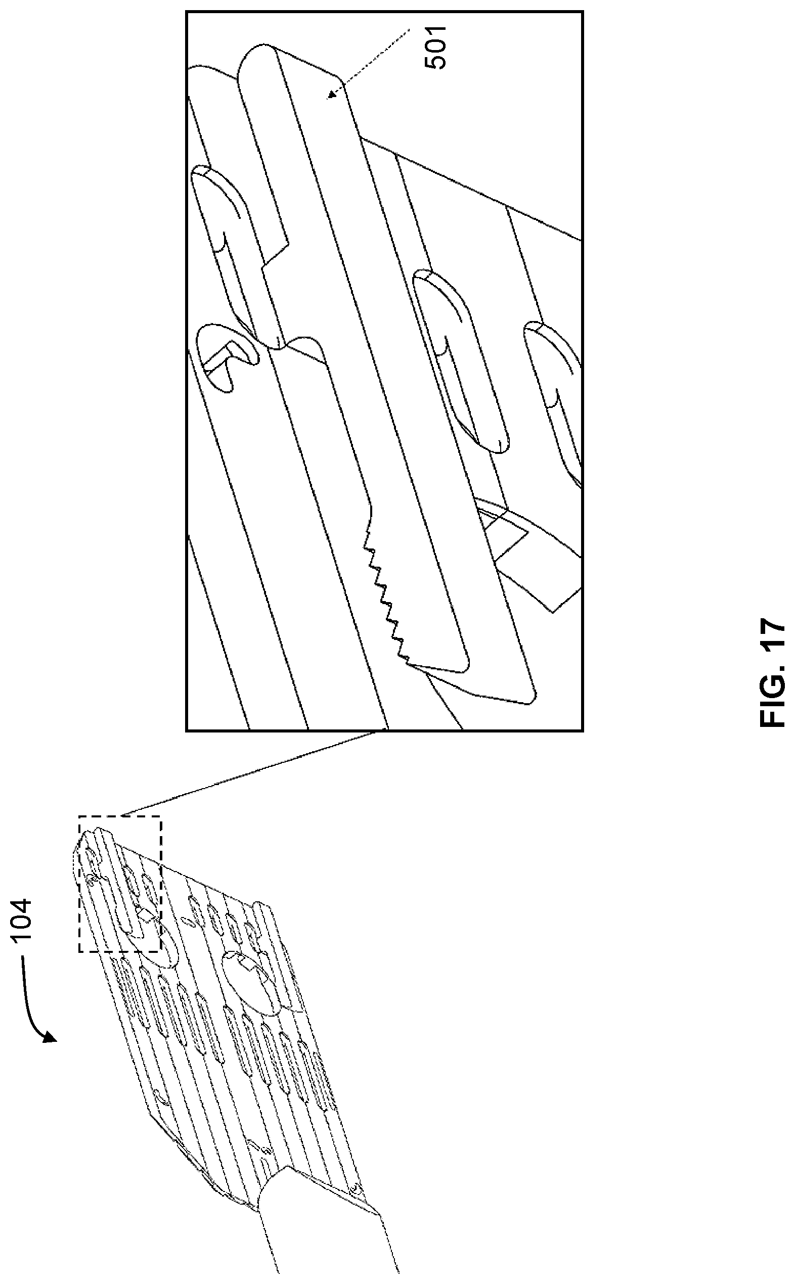 Patent US11779371 Figure 14 – Implant delivery device