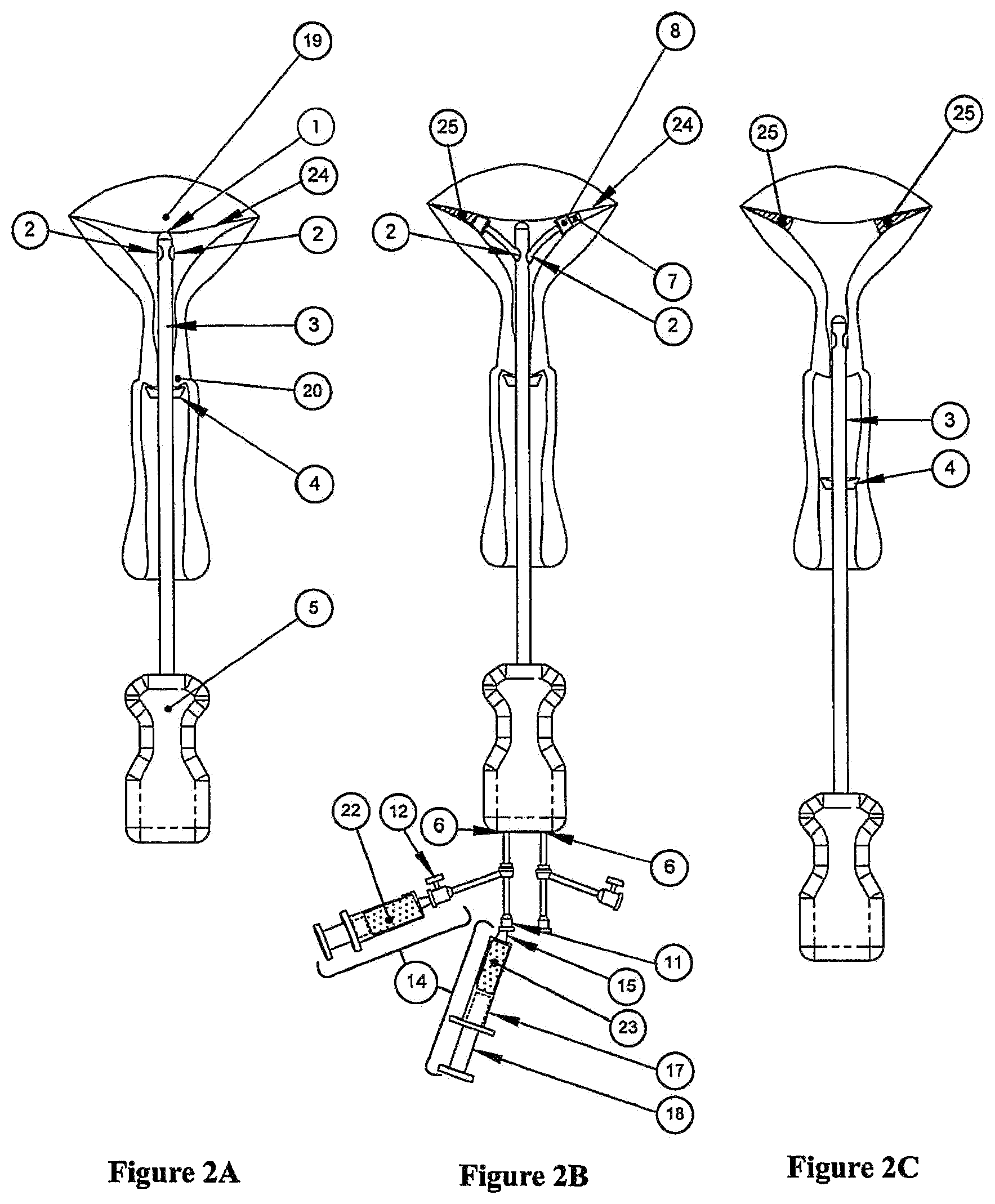 Patent US11779372 Figure 2 – Methods and devices for conduit occlusion