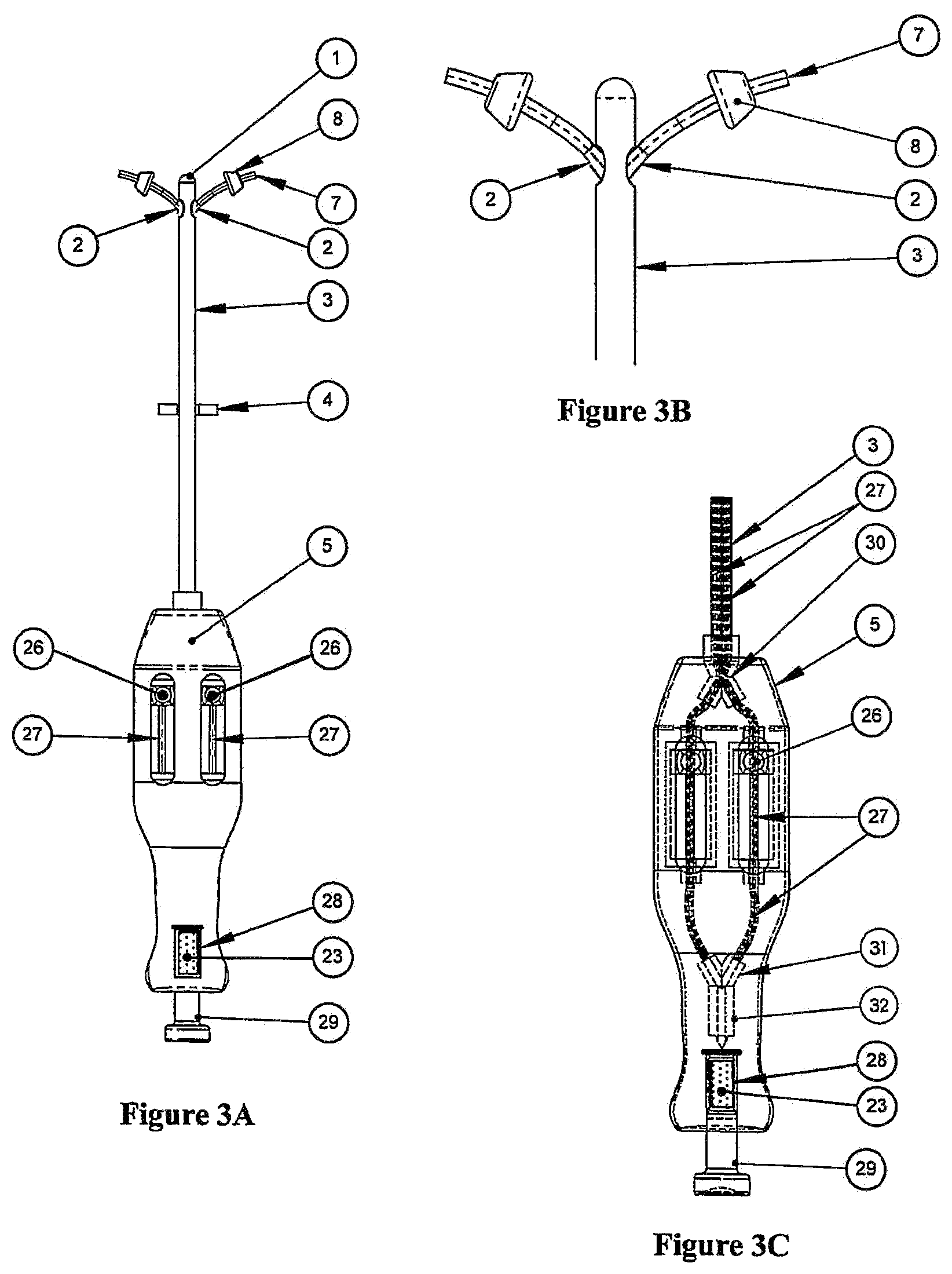 Patent US11779372 Figure 3 – Methods and devices for conduit occlusion