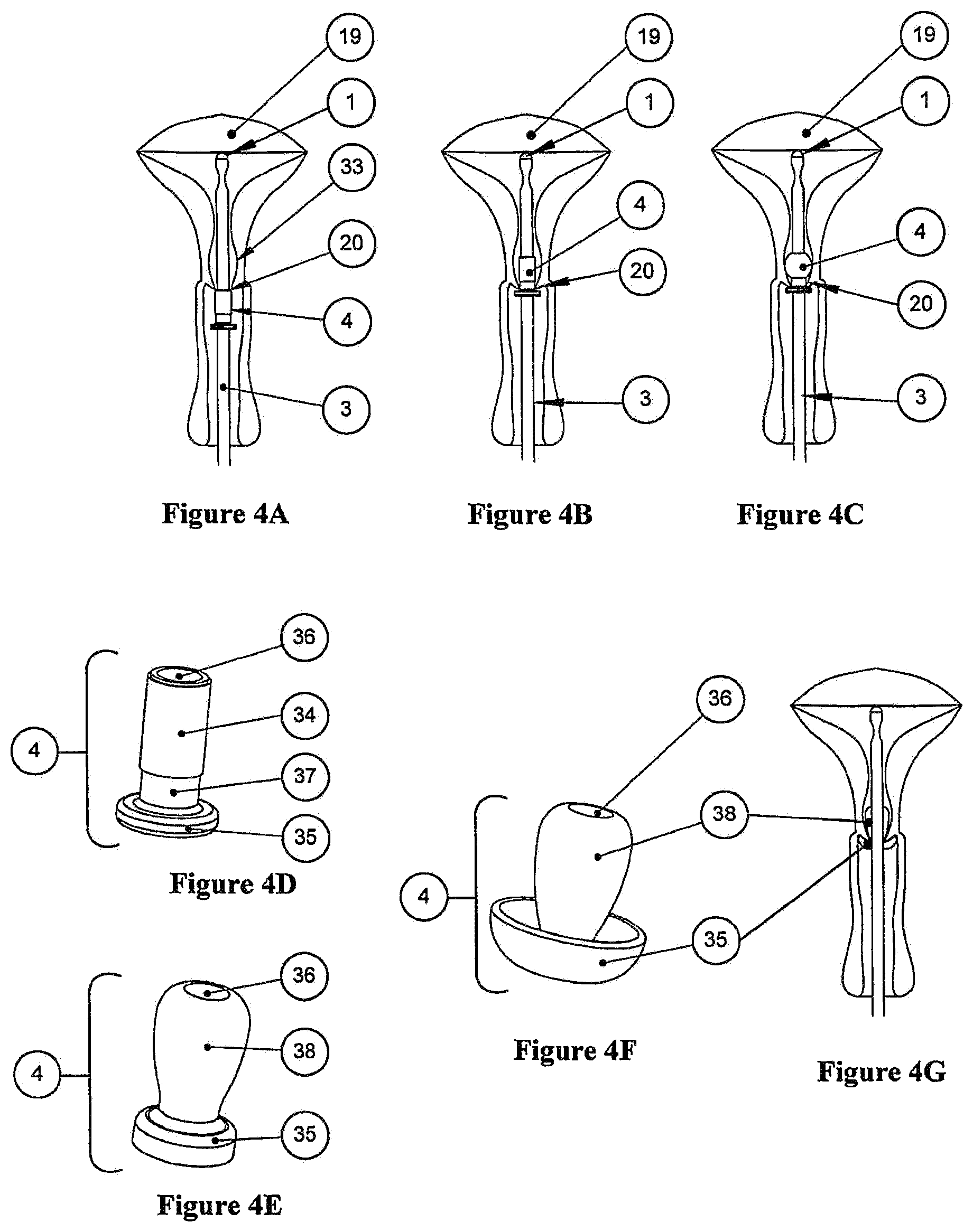 Patent US11779372 Figure 4 – Methods and devices for conduit occlusion