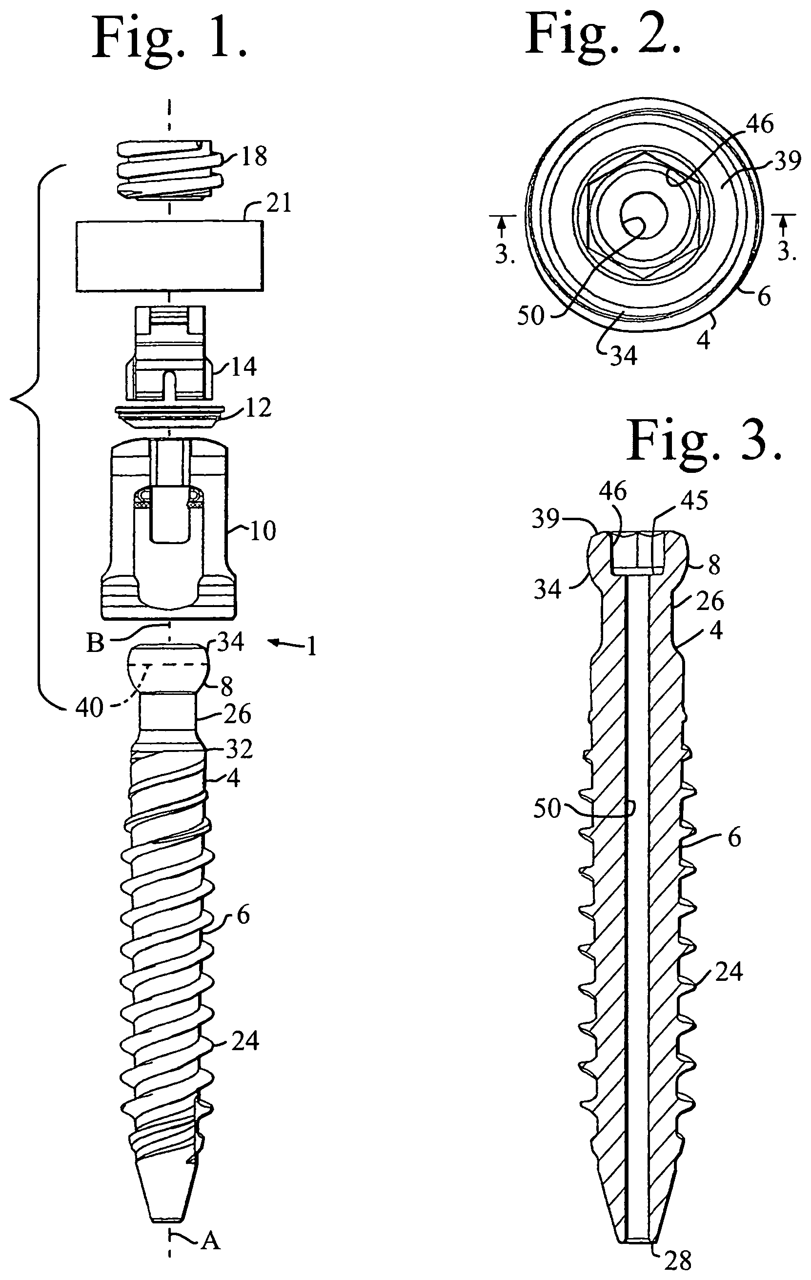Patent US11779374 Figure 1 – Pivotal bone anchor assembly with non-pivoting, non-rotatable retainer