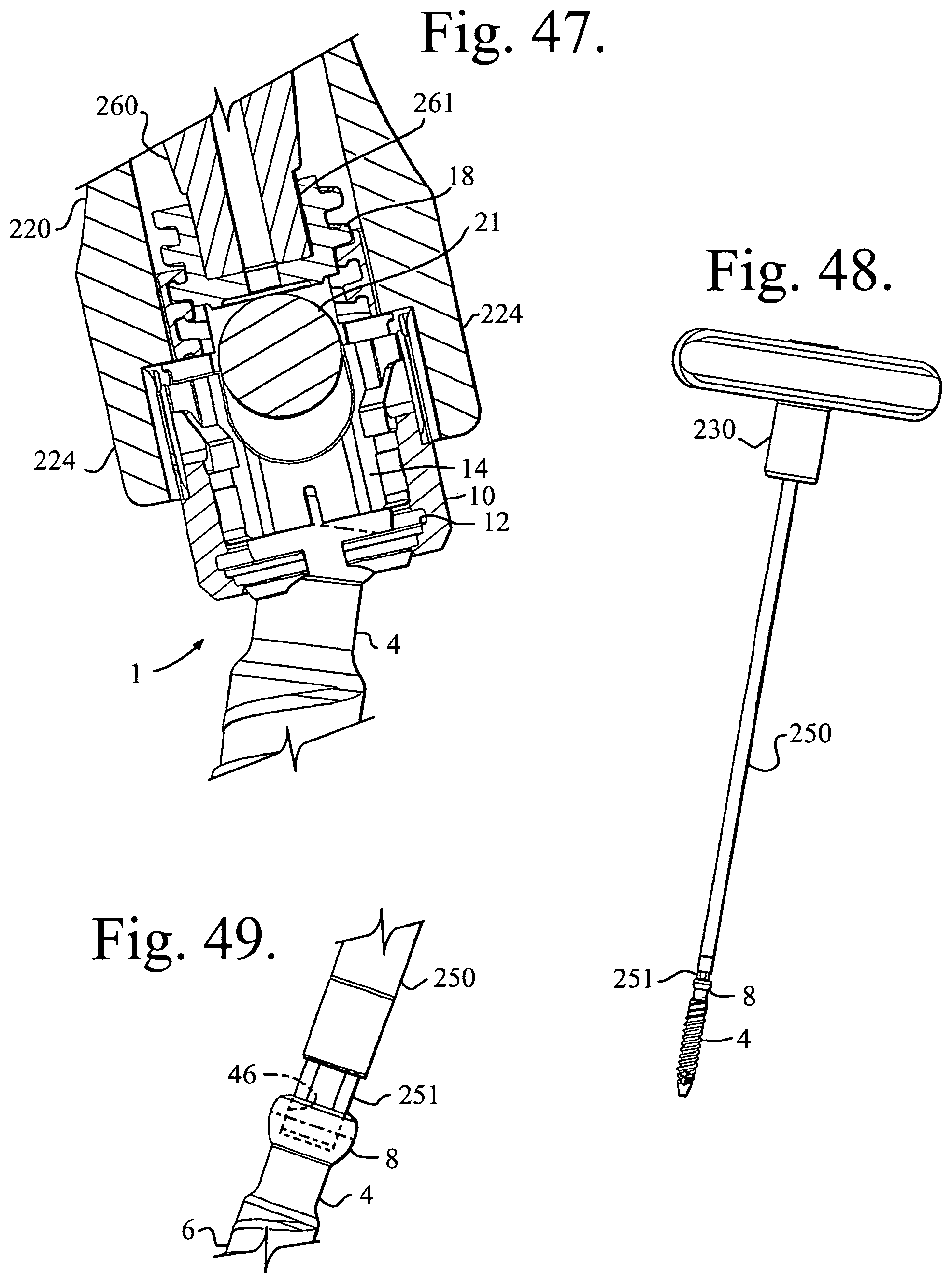 Patent US11779374 Figure 17 – Pivotal bone anchor assembly with non-pivoting, non-rotatable retainer