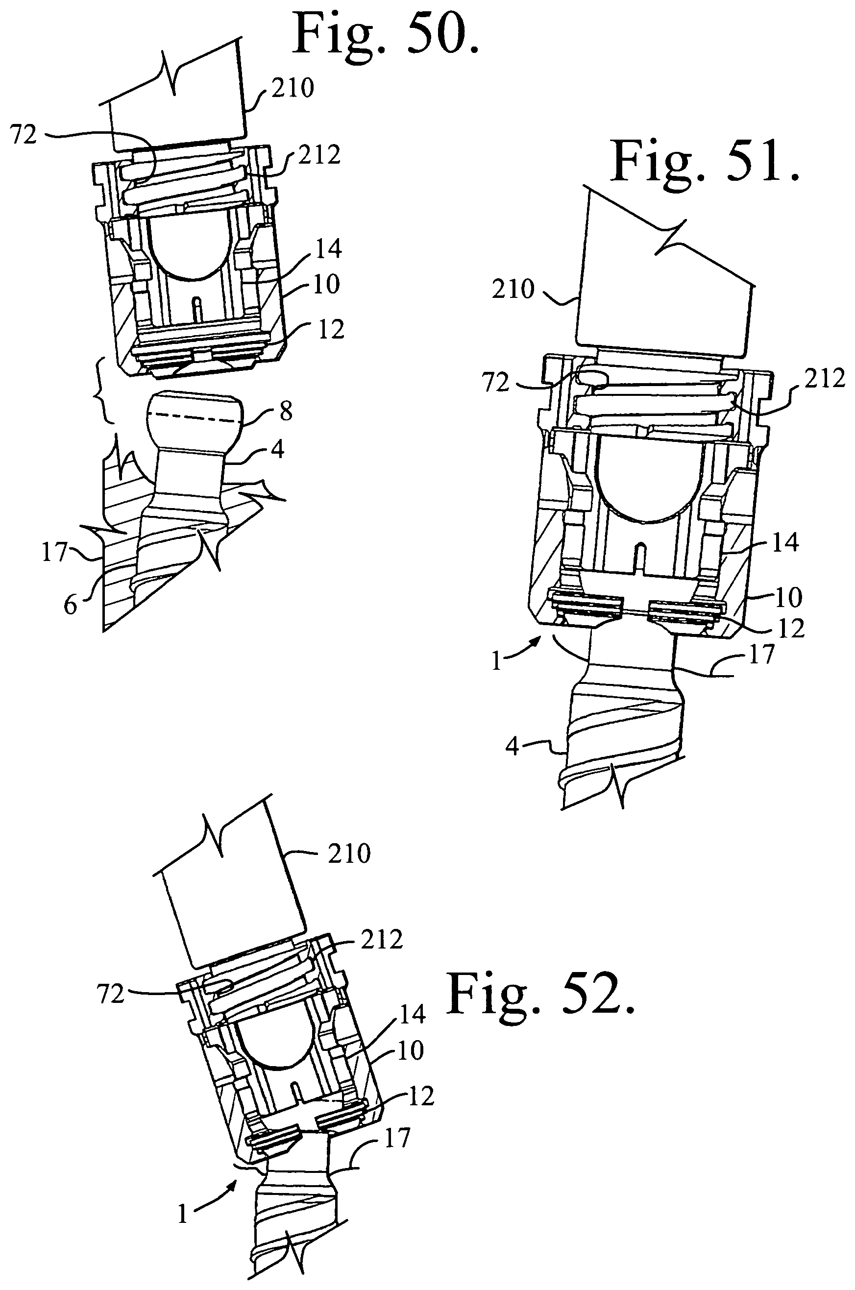 Patent US11779374 Figure 18 – Pivotal bone anchor assembly with non-pivoting, non-rotatable retainer