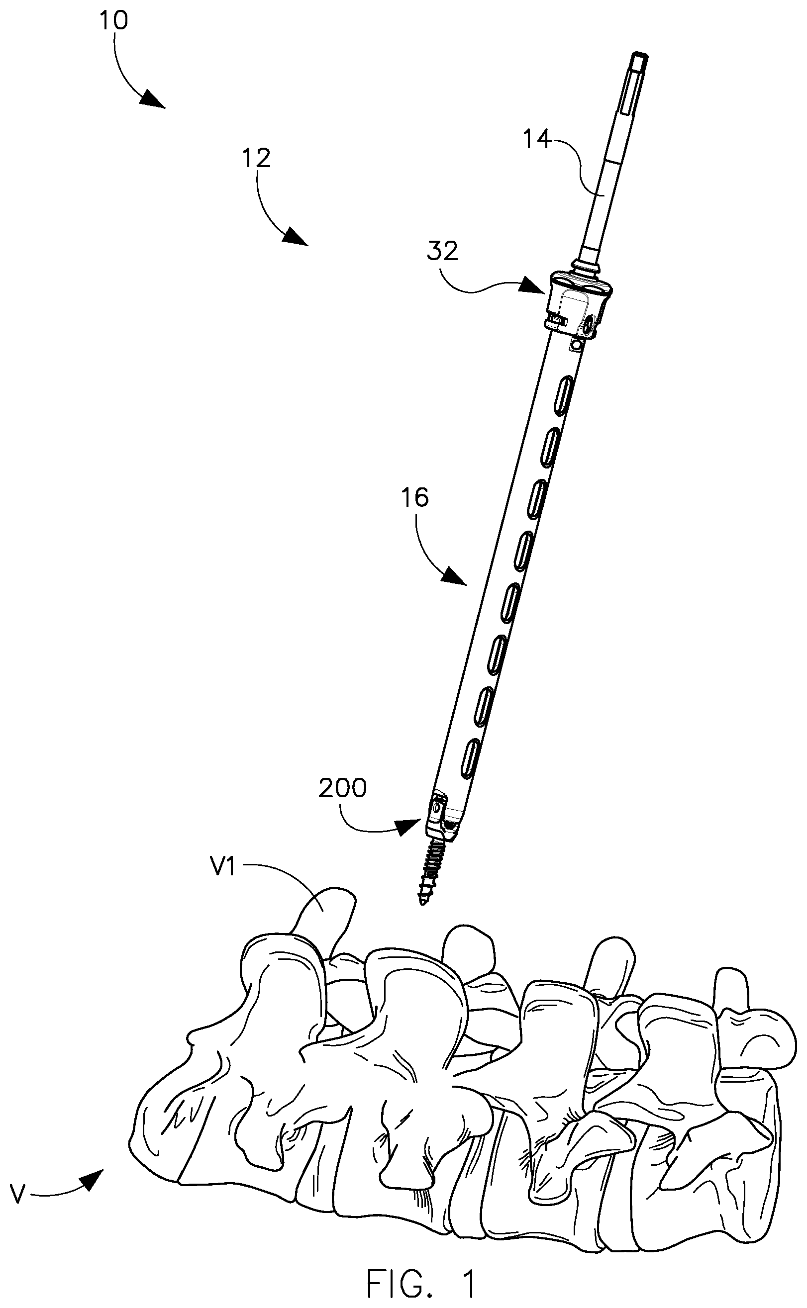 Patent US11779376 — Surgical instrument and method — Figure 1