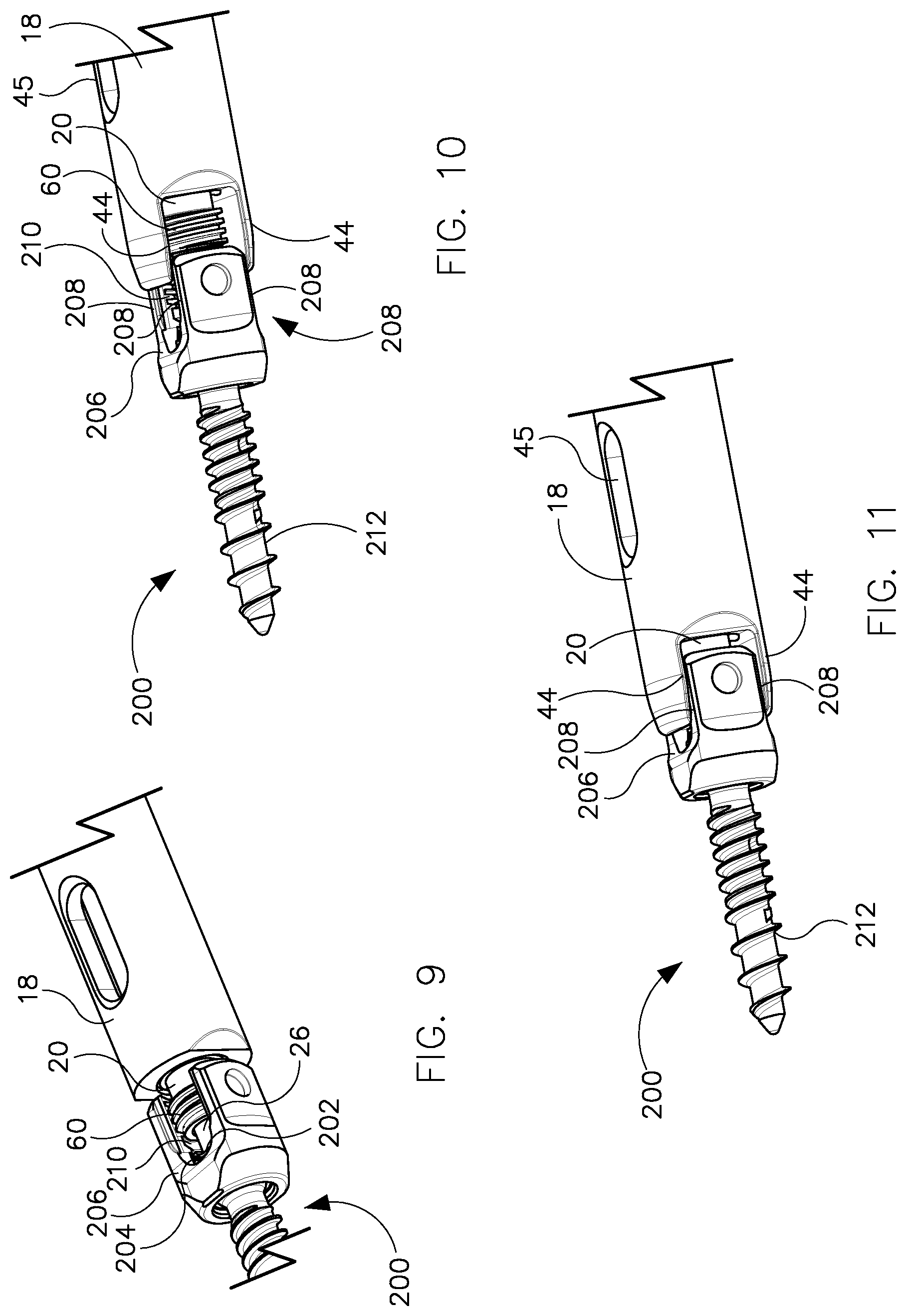 Patent US11779376 Figure 8 – Surgical instrument and method