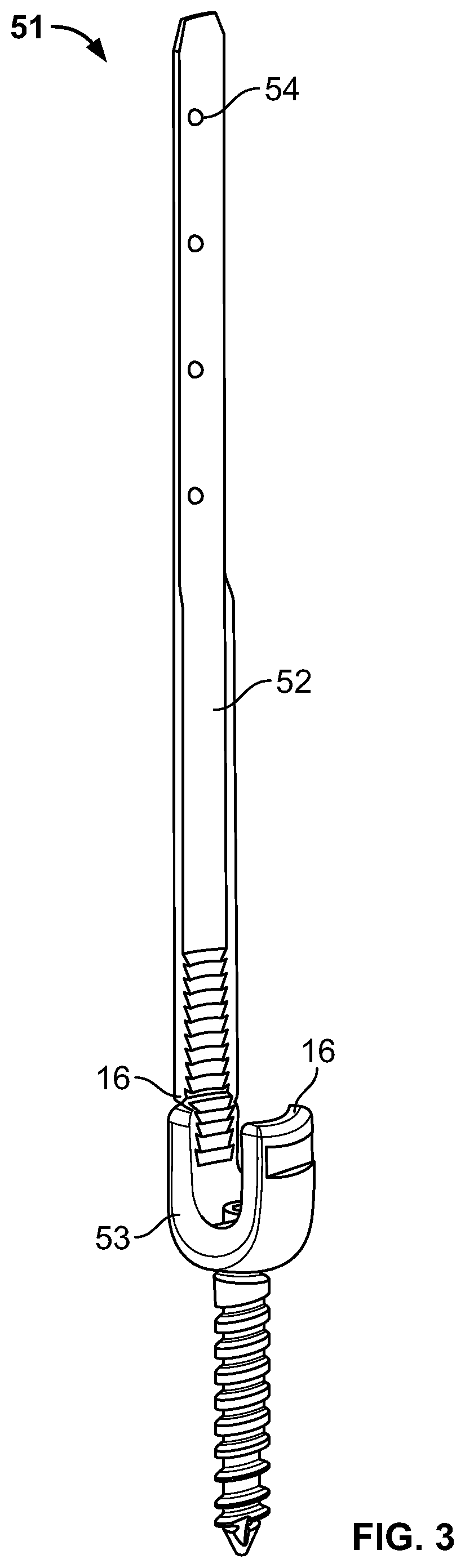 Patent US11779377 Figure 4 – Systems and methods for percutaneous spinal fusion