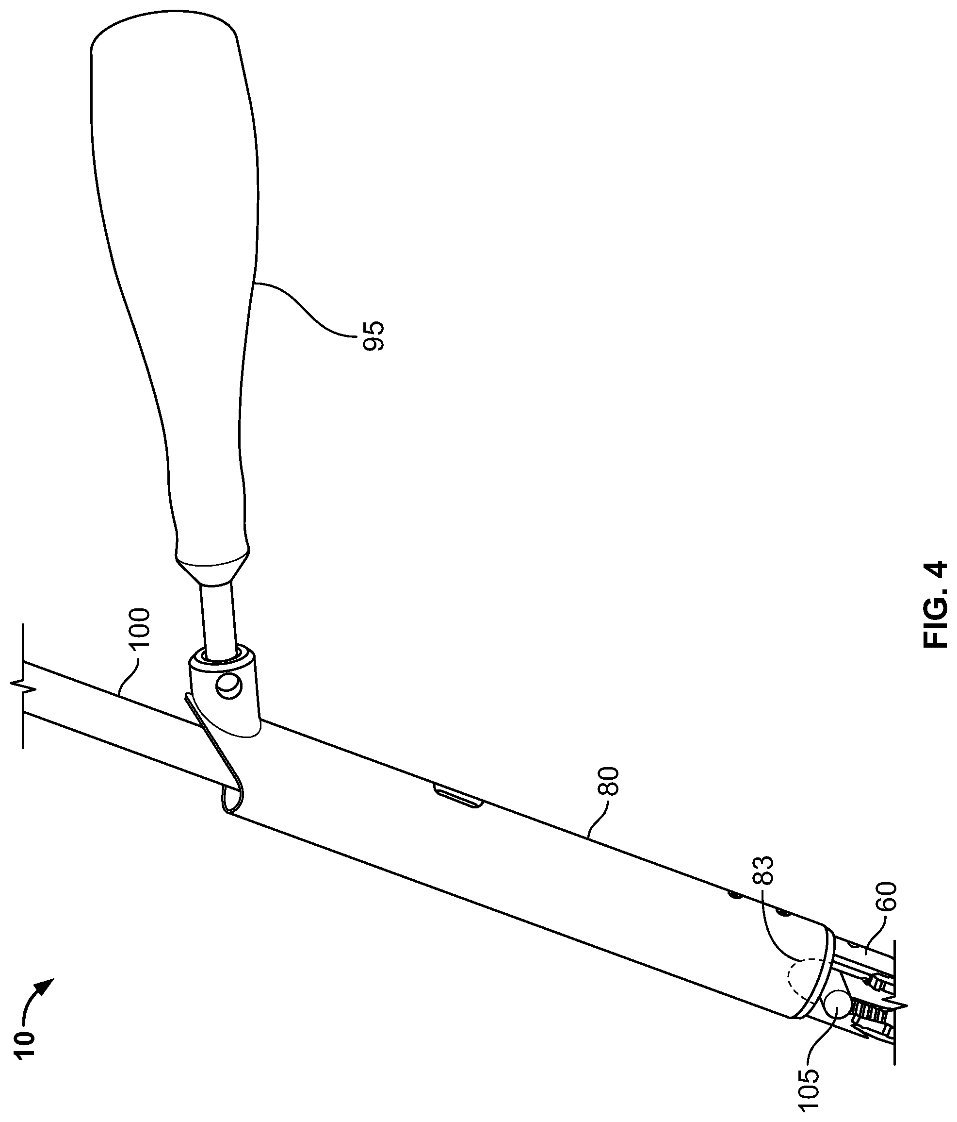 Patent US11779377 Figure 5 – Systems and methods for percutaneous spinal fusion