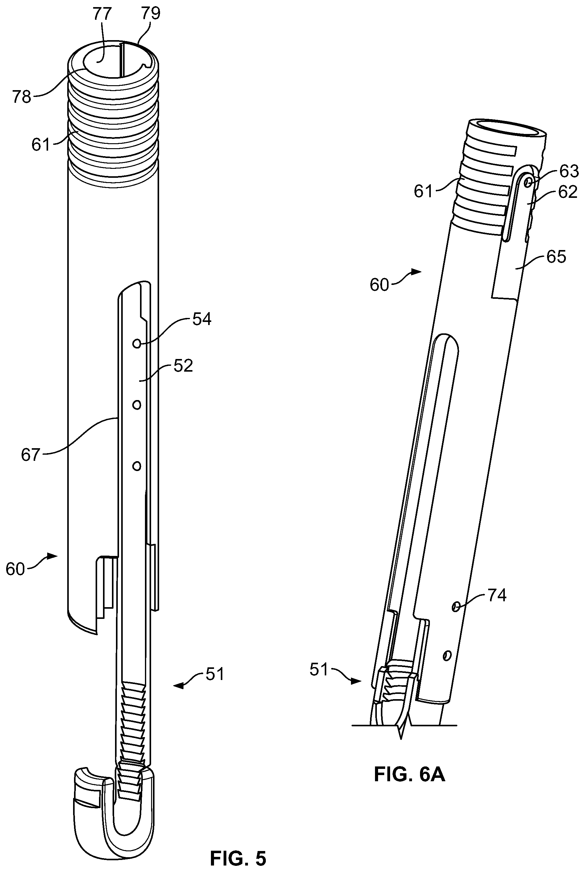 Patent US11779377 Figure 6 – Systems and methods for percutaneous spinal fusion