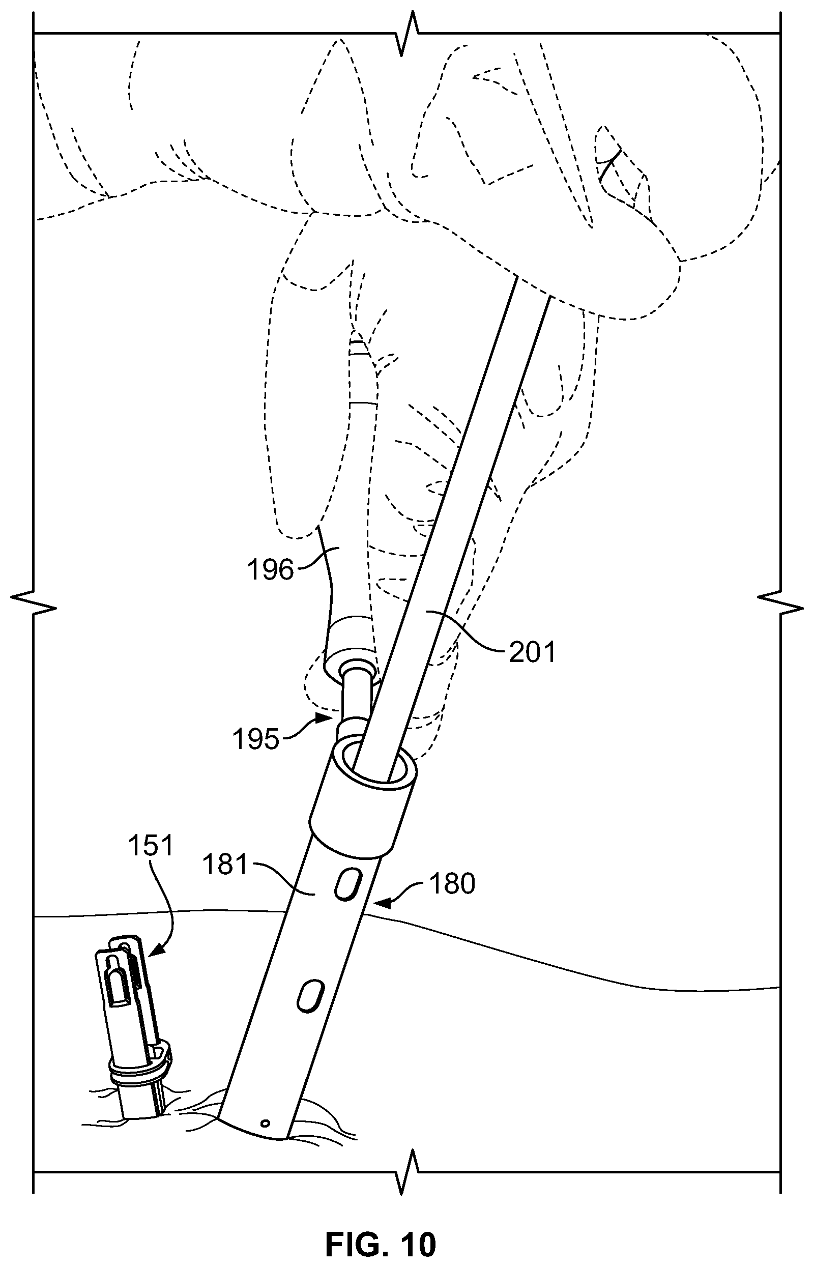 Patent US11779377 Figure 10 – Systems and methods for percutaneous spinal fusion