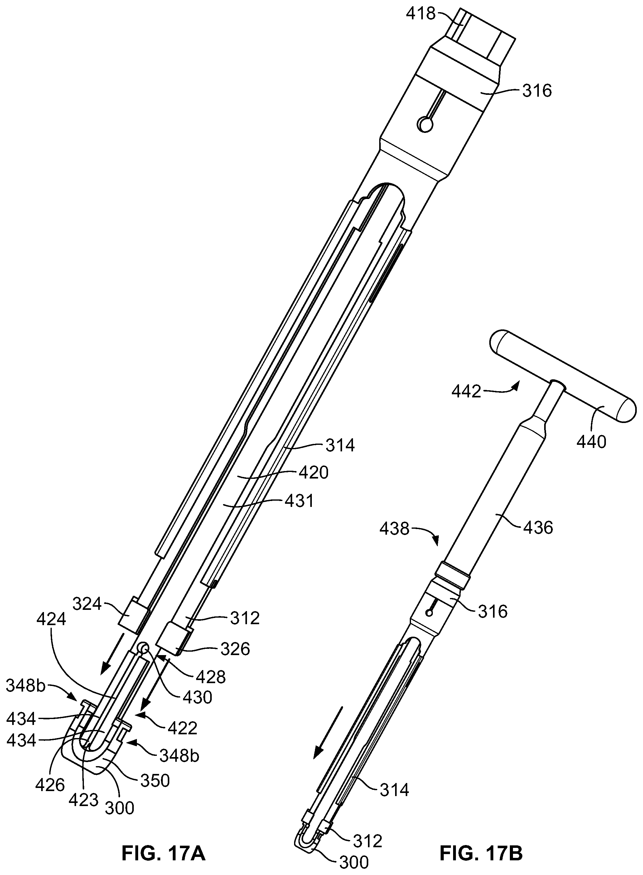 Patent US11779377 Figure 17 – Systems and methods for percutaneous spinal fusion