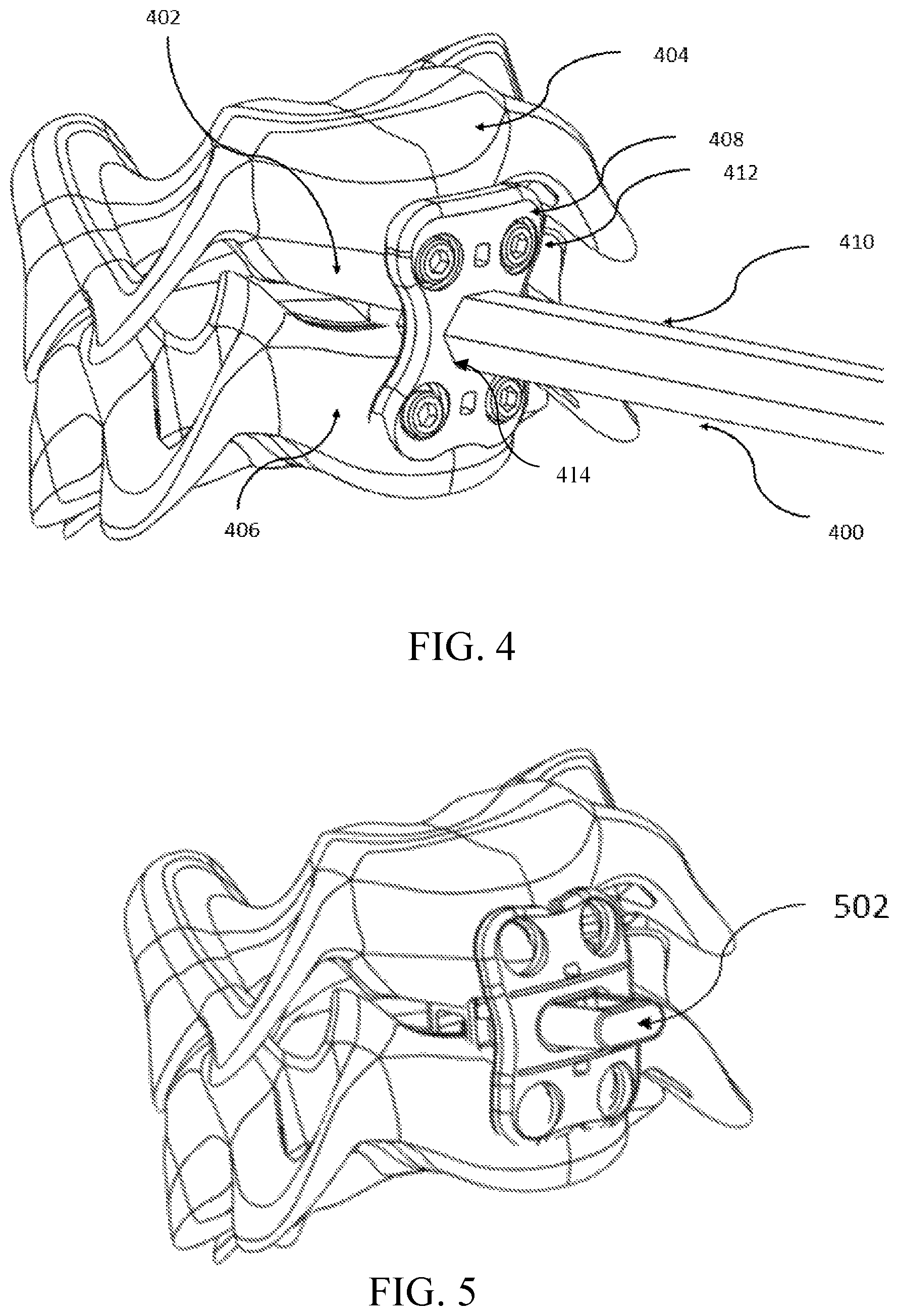 Patent US11779378 Figure 5 – Self-aligning plating system and method