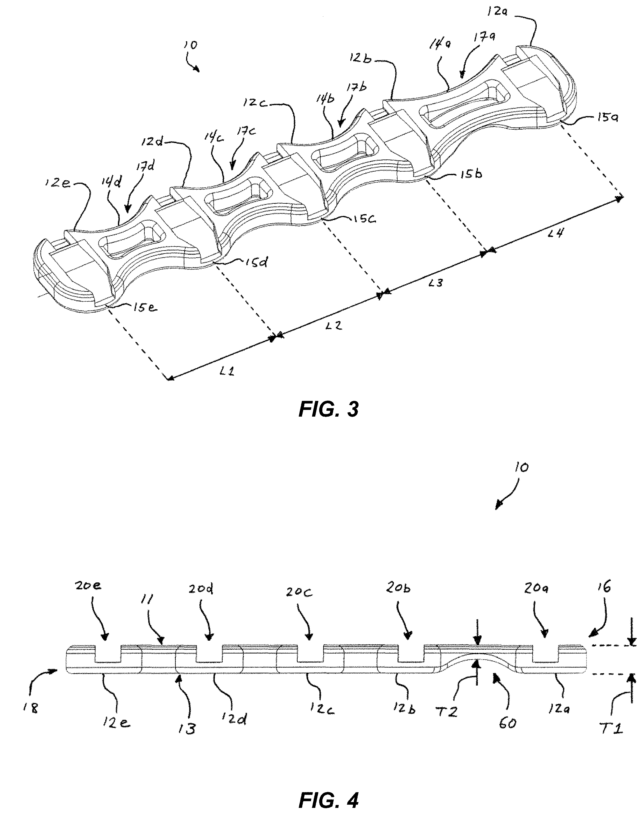 Patent US11779379 Figure 3 – Sternum fixation devices and methods