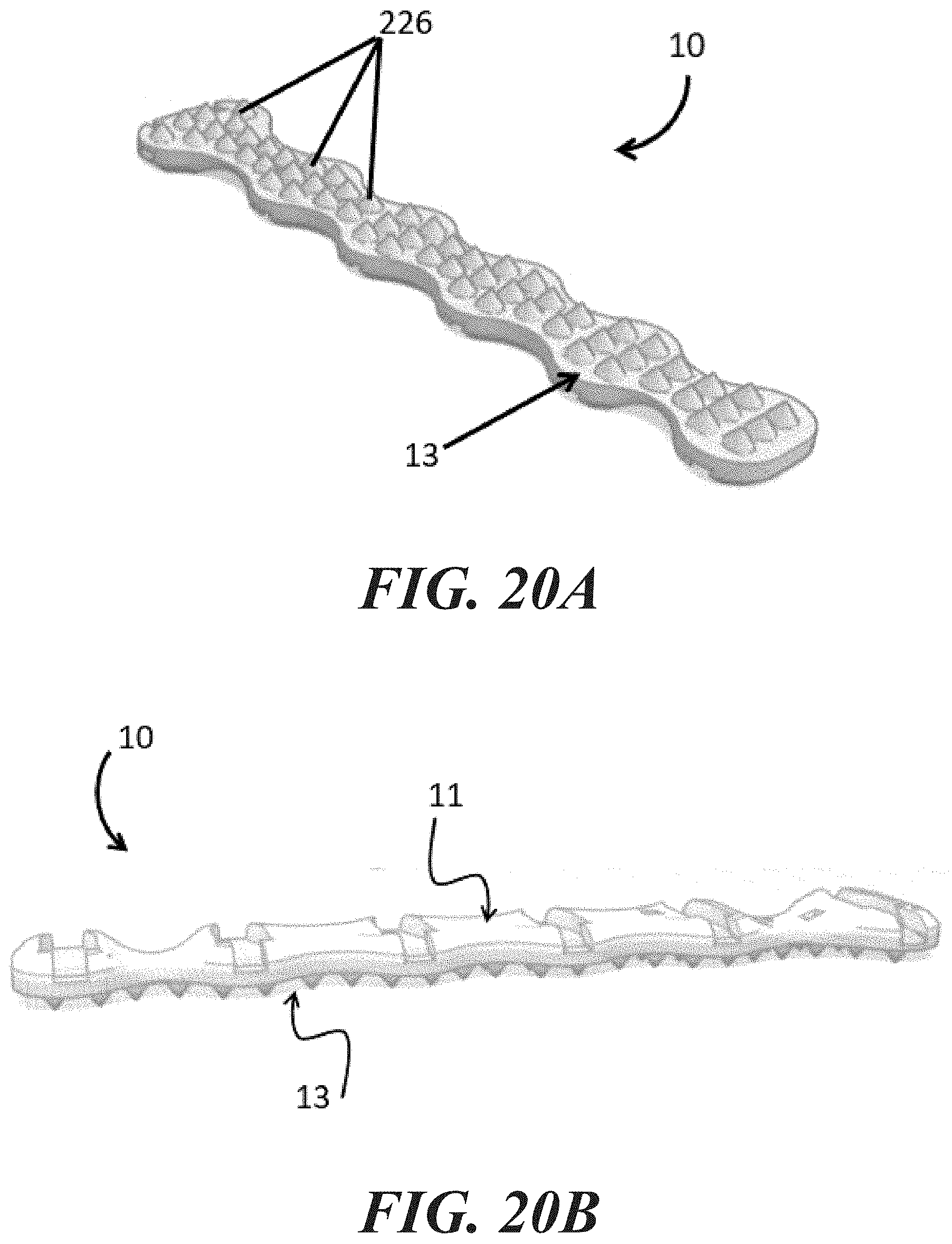 Patent US11779379 Figure 14 – Sternum fixation devices and methods