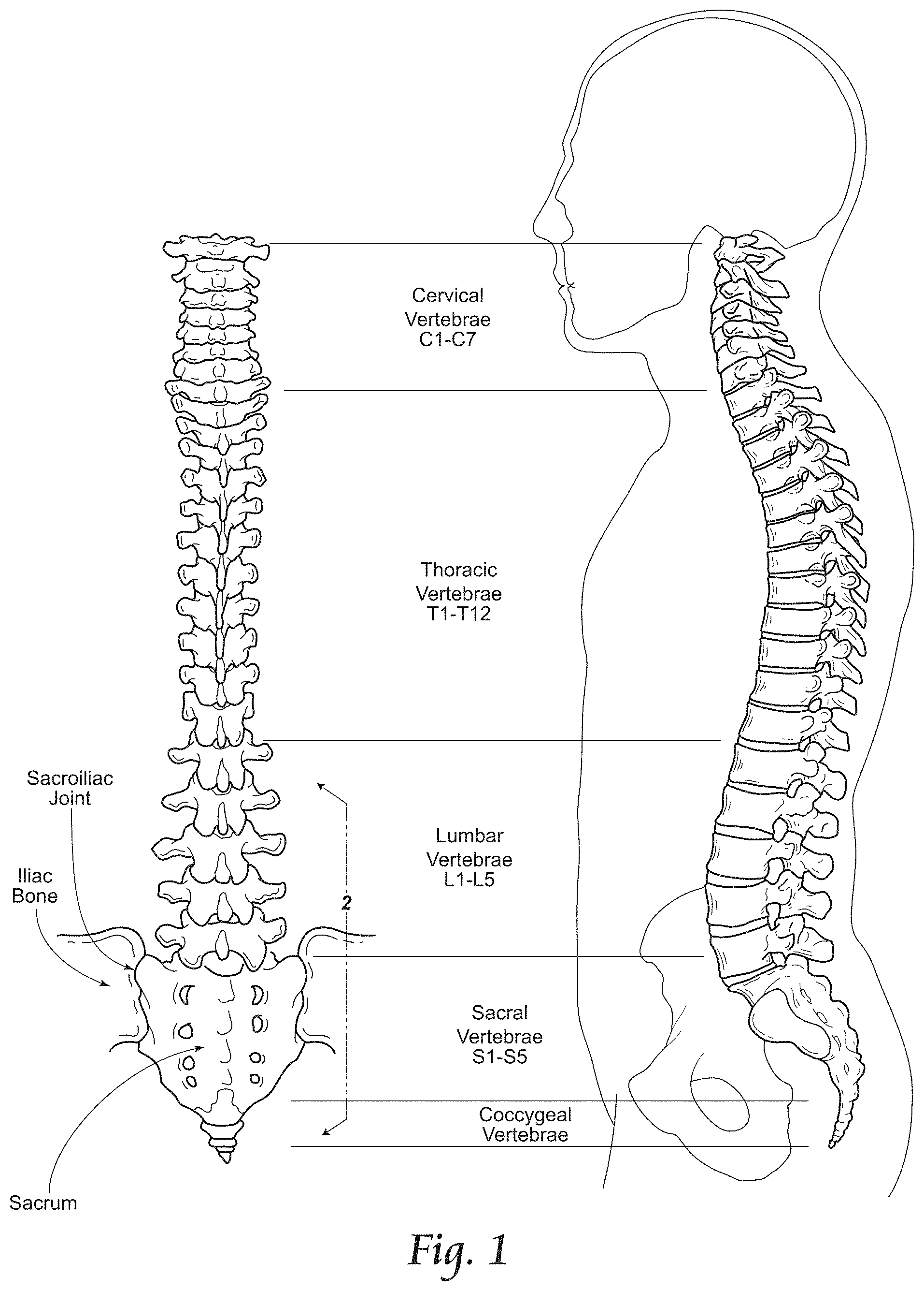 Patent US11779380 Figure 1 – Methods, systems, and devices for the treatment of stenosis