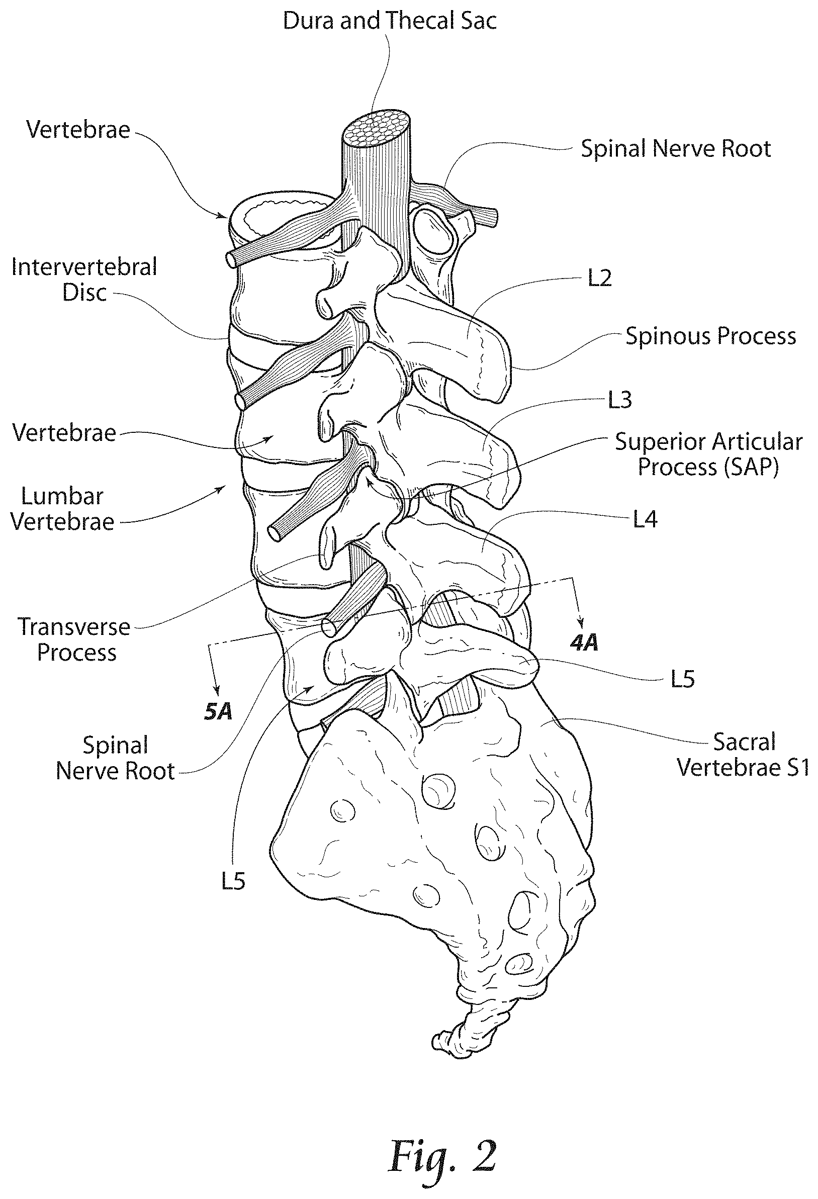 Patent US11779380 Figure 2 – Methods, systems, and devices for the treatment of stenosis