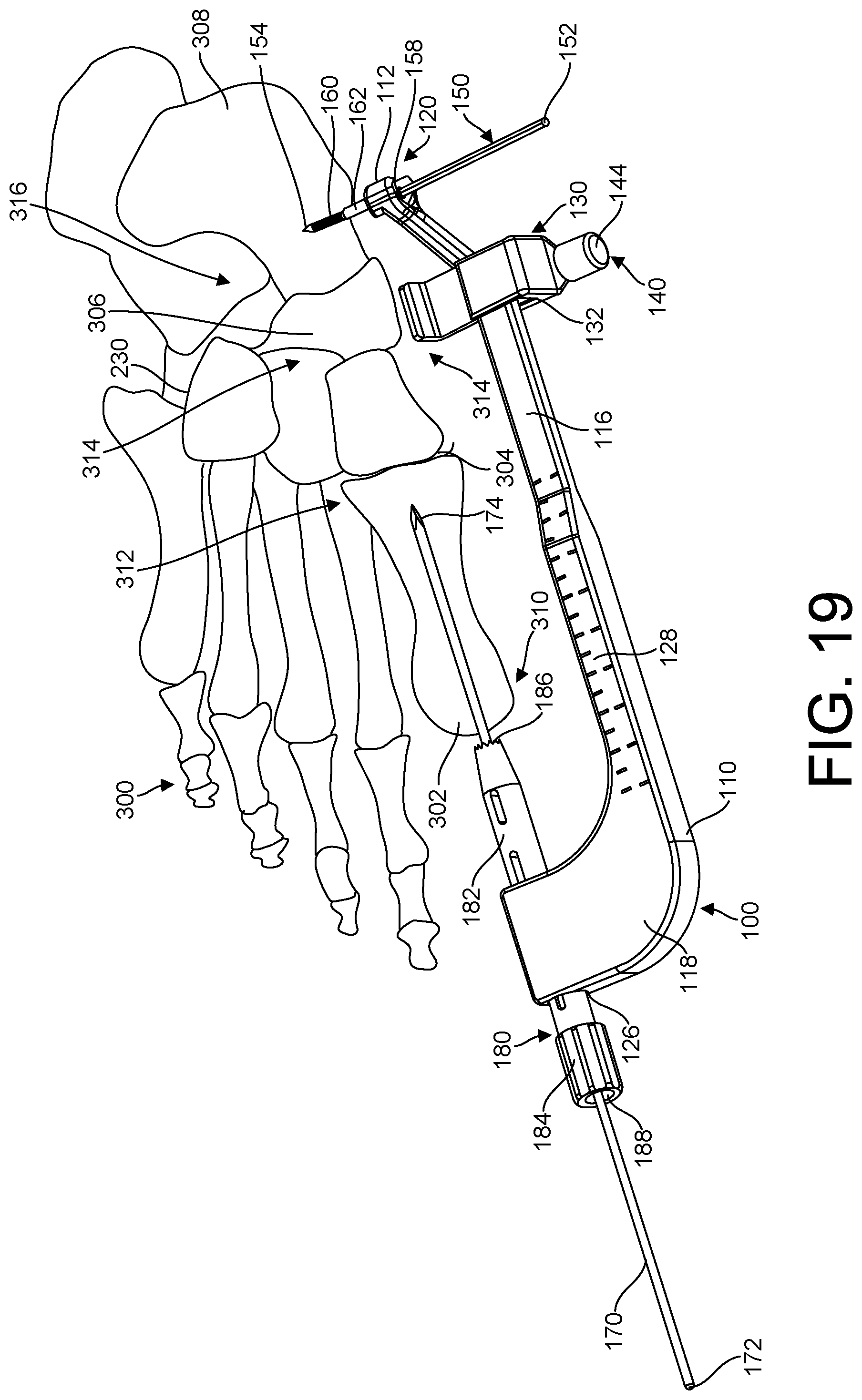 Patent US11779381 Figure 15 – Bone fixation system, assembly, implants, devices, alignment guides, and methods of use