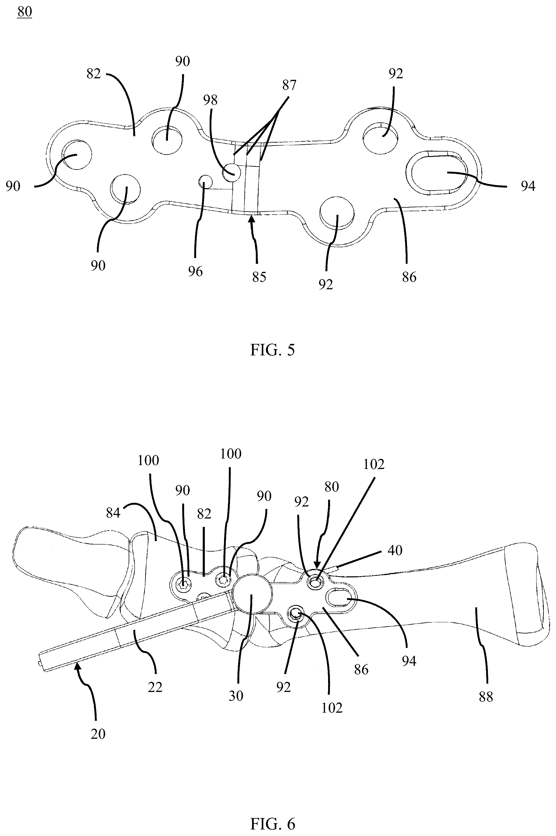 Patent US11779382 Figure 4 – Alignment guide apparatus, methods and systems