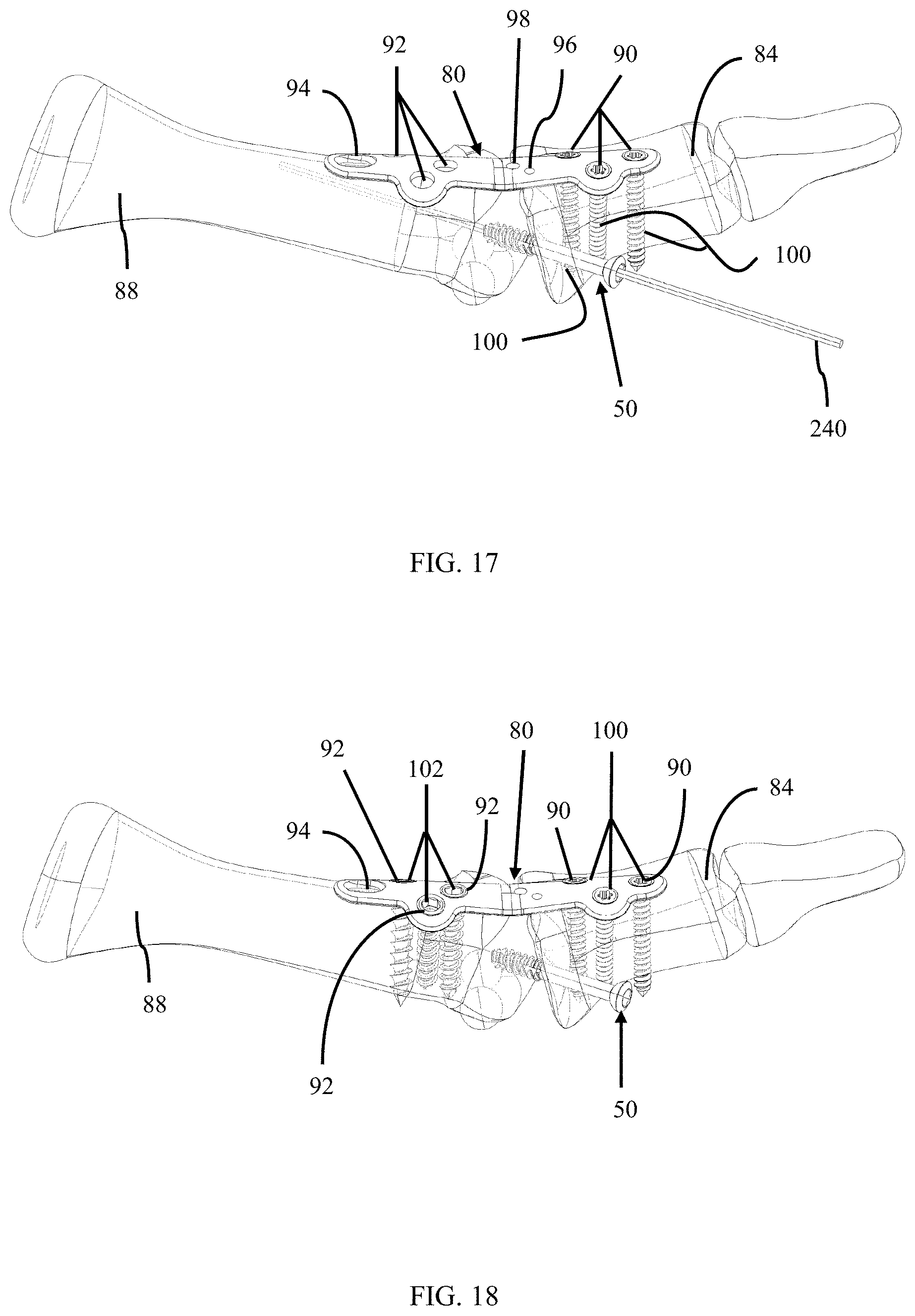 Patent US11779382 Figure 11 – Alignment guide apparatus, methods and systems