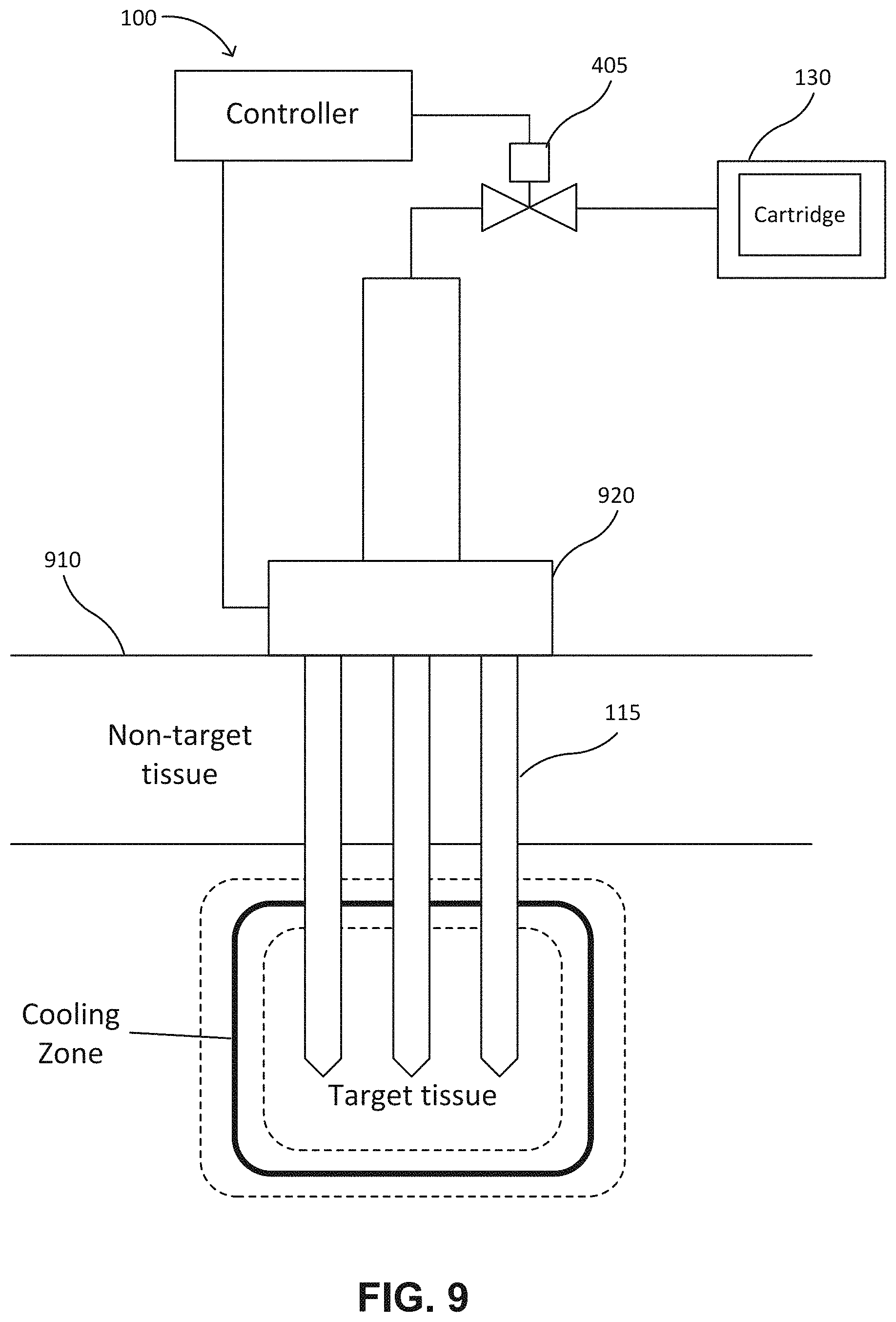 Patent US11779383 Figure 12 – Stabilizing pressure in cryogenic devices